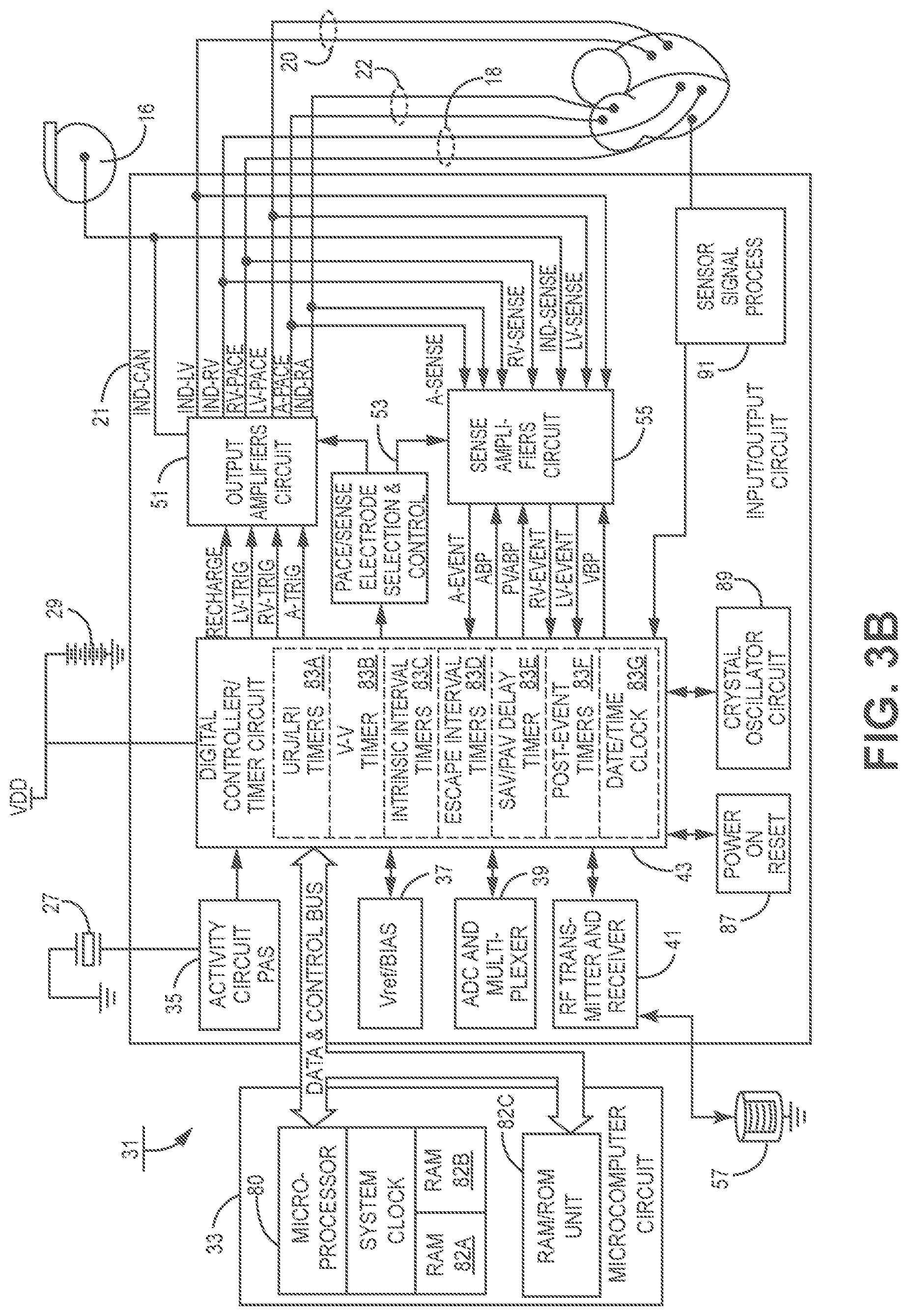 Patent US12508428 Figure 4 – Respiratory-based cardiac remodeling pacing therapy