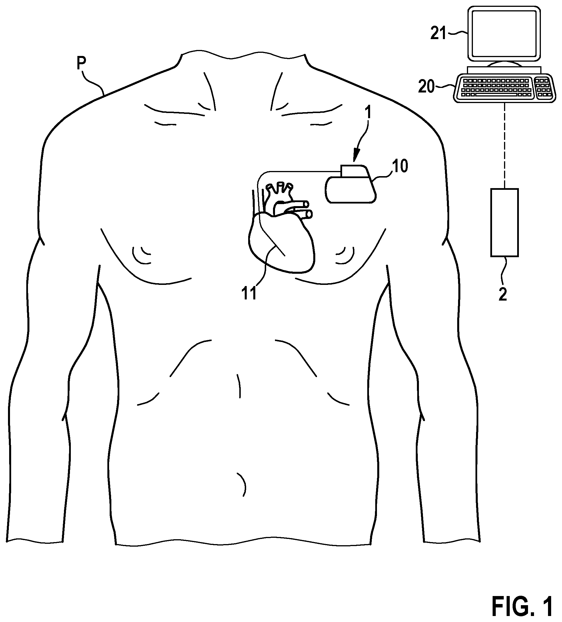 Patent US12508429 Figure 1 – Medical system for performing a therapeutic function on a patient