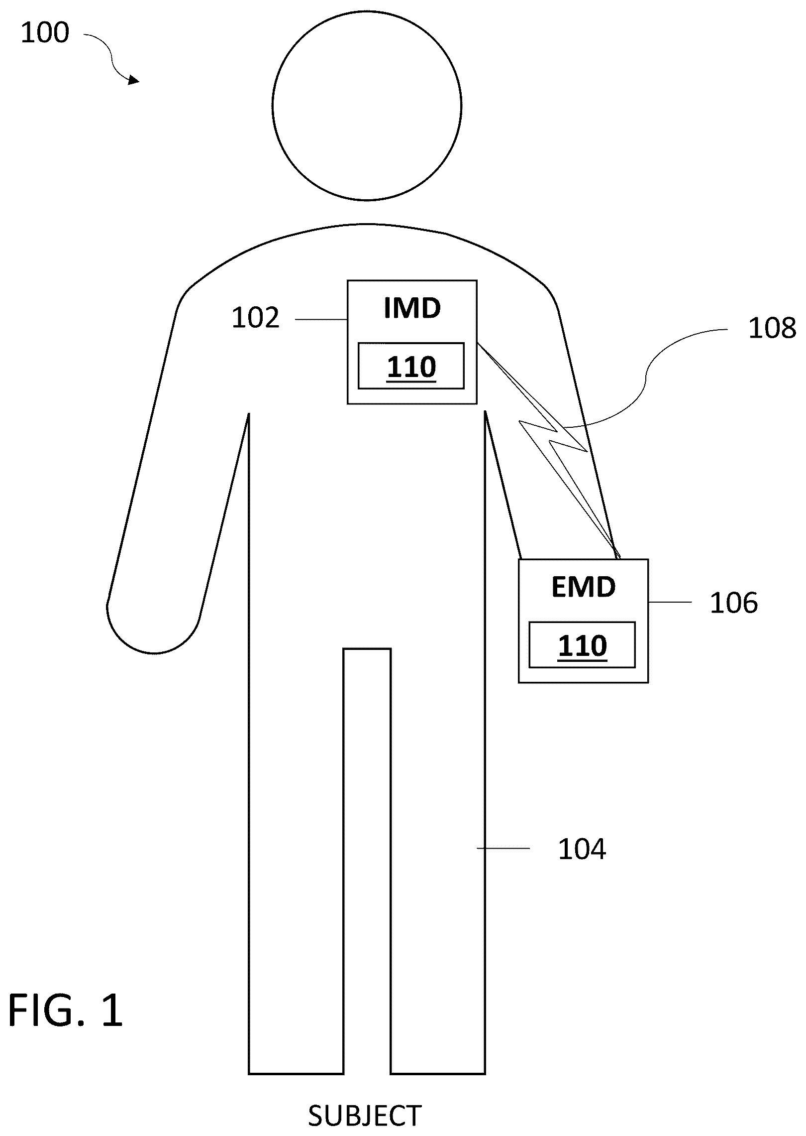 Patent US12508430 — Systems and methods for detecting implantable device rotation via heart sound morphology — Figure 1