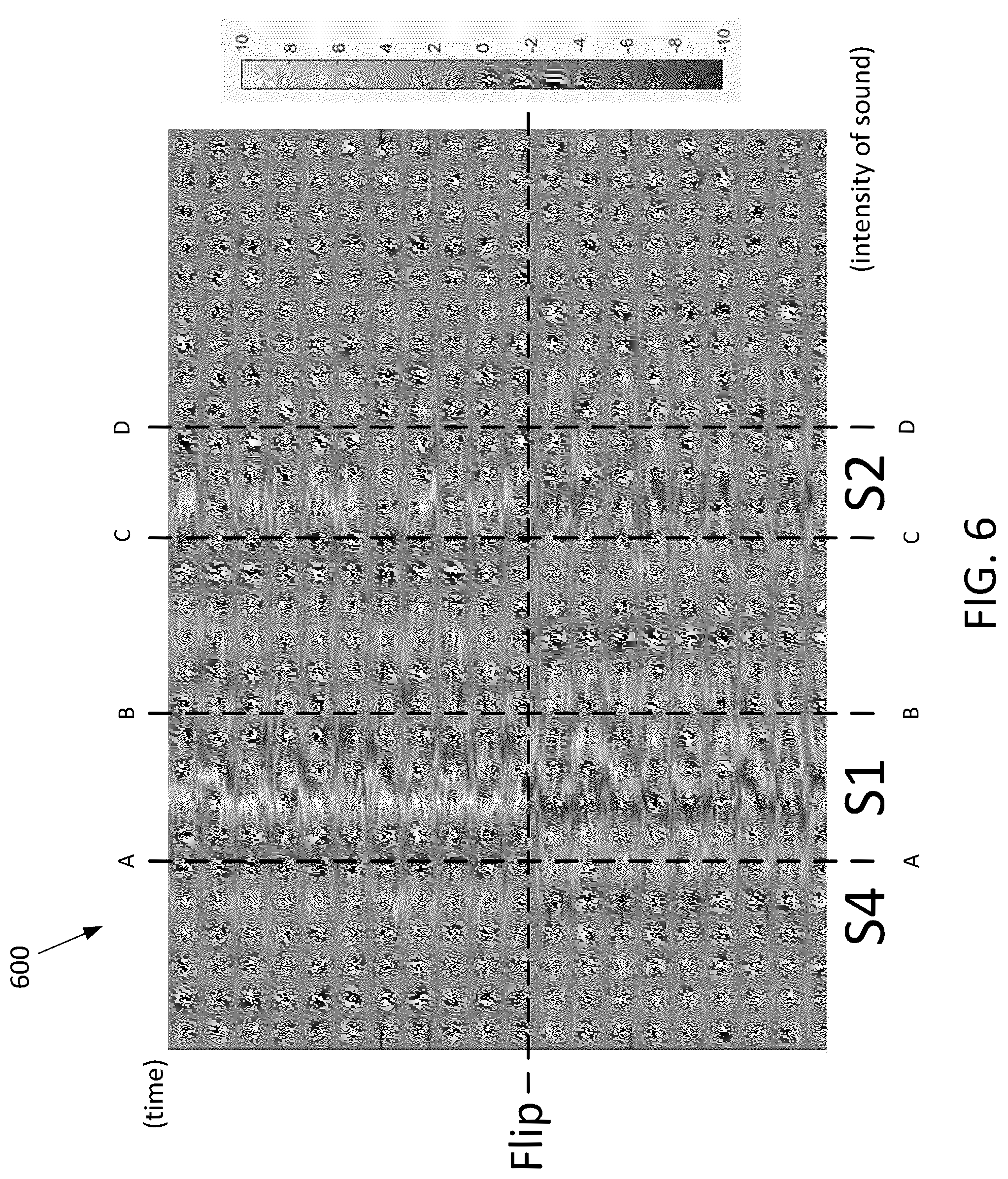 Patent US12508430 Figure 5 – Systems and methods for detecting implantable device rotation via heart sound morphology