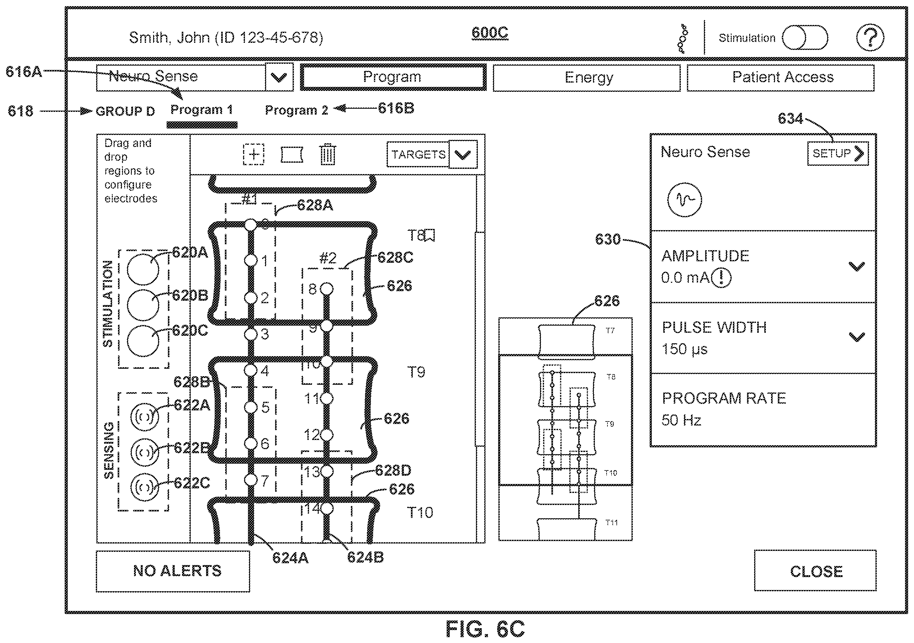 Patent US12508433 Figure 9 – Therapy programming based on evoked compound action potentials