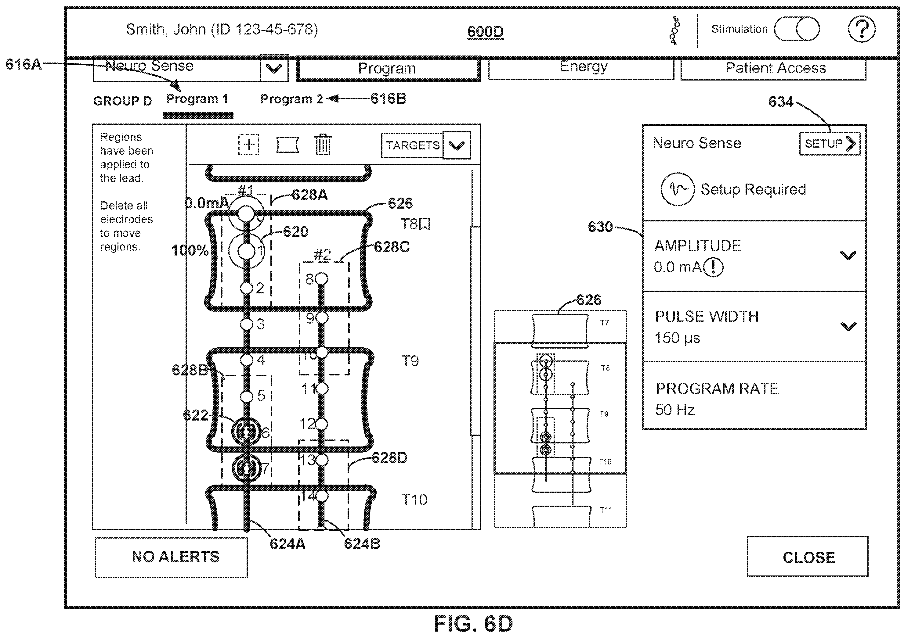 Patent US12508433 Figure 10 – Therapy programming based on evoked compound action potentials