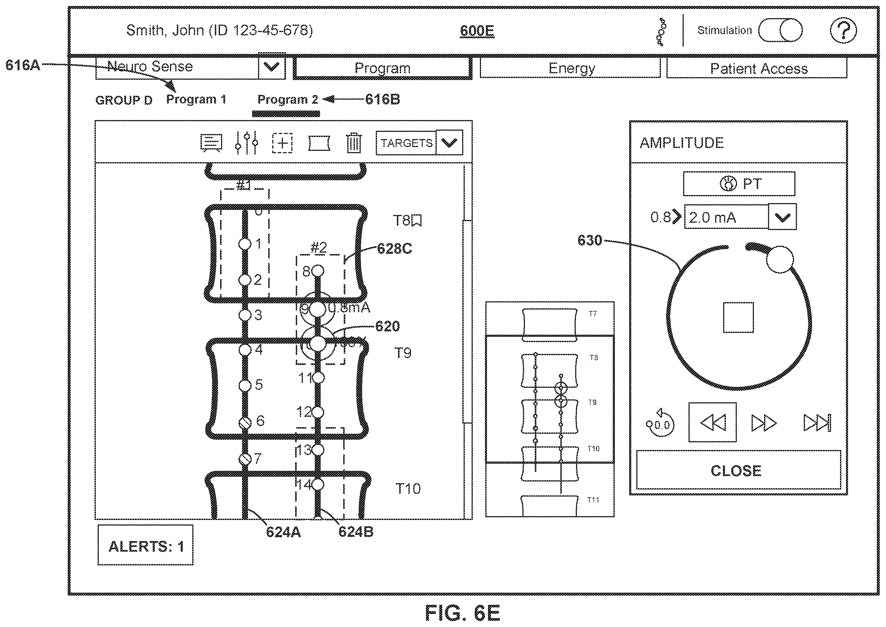 Patent US12508433 Figure 11 – Therapy programming based on evoked compound action potentials