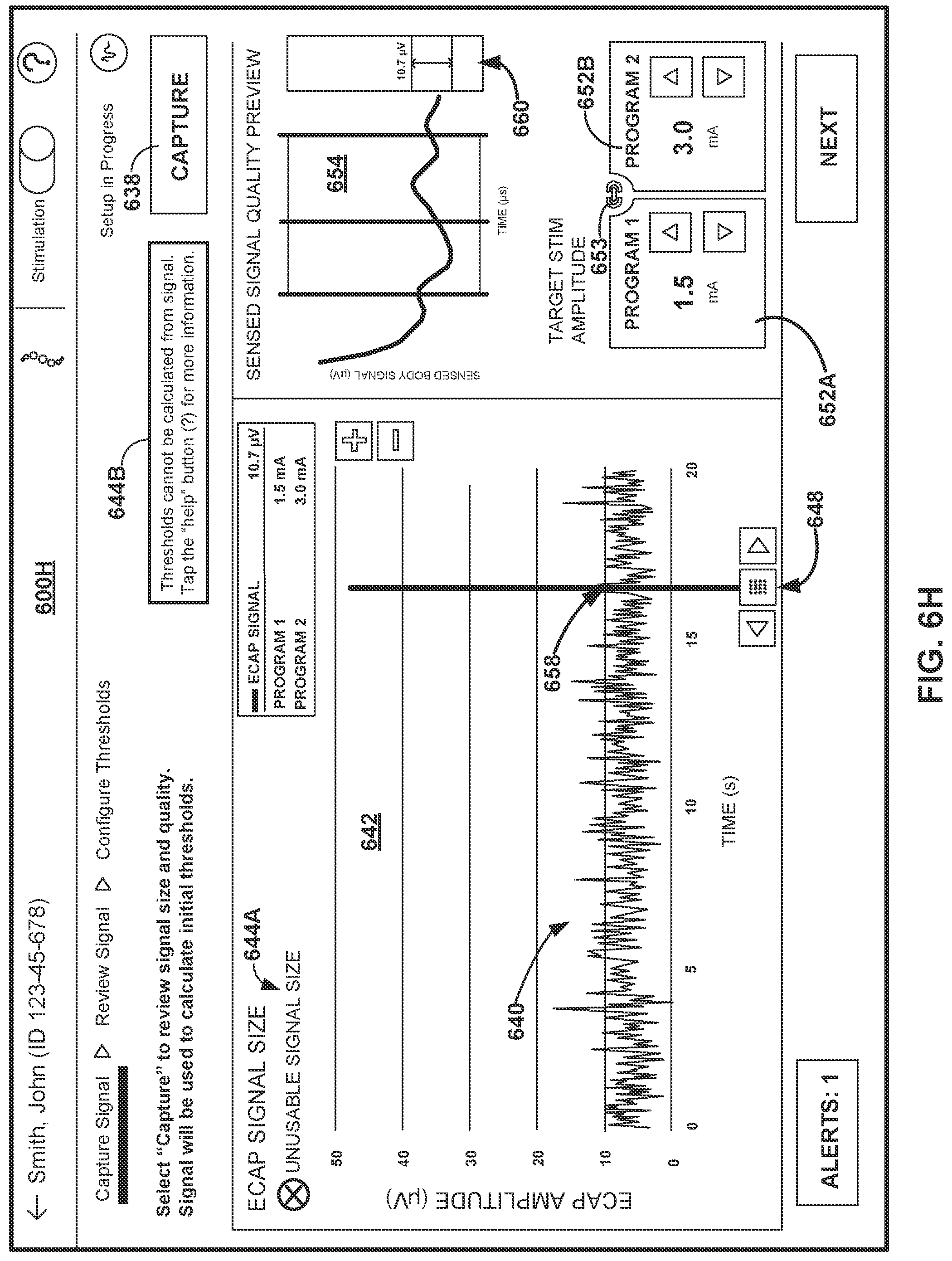 Patent US12508433 Figure 14 – Therapy programming based on evoked compound action potentials