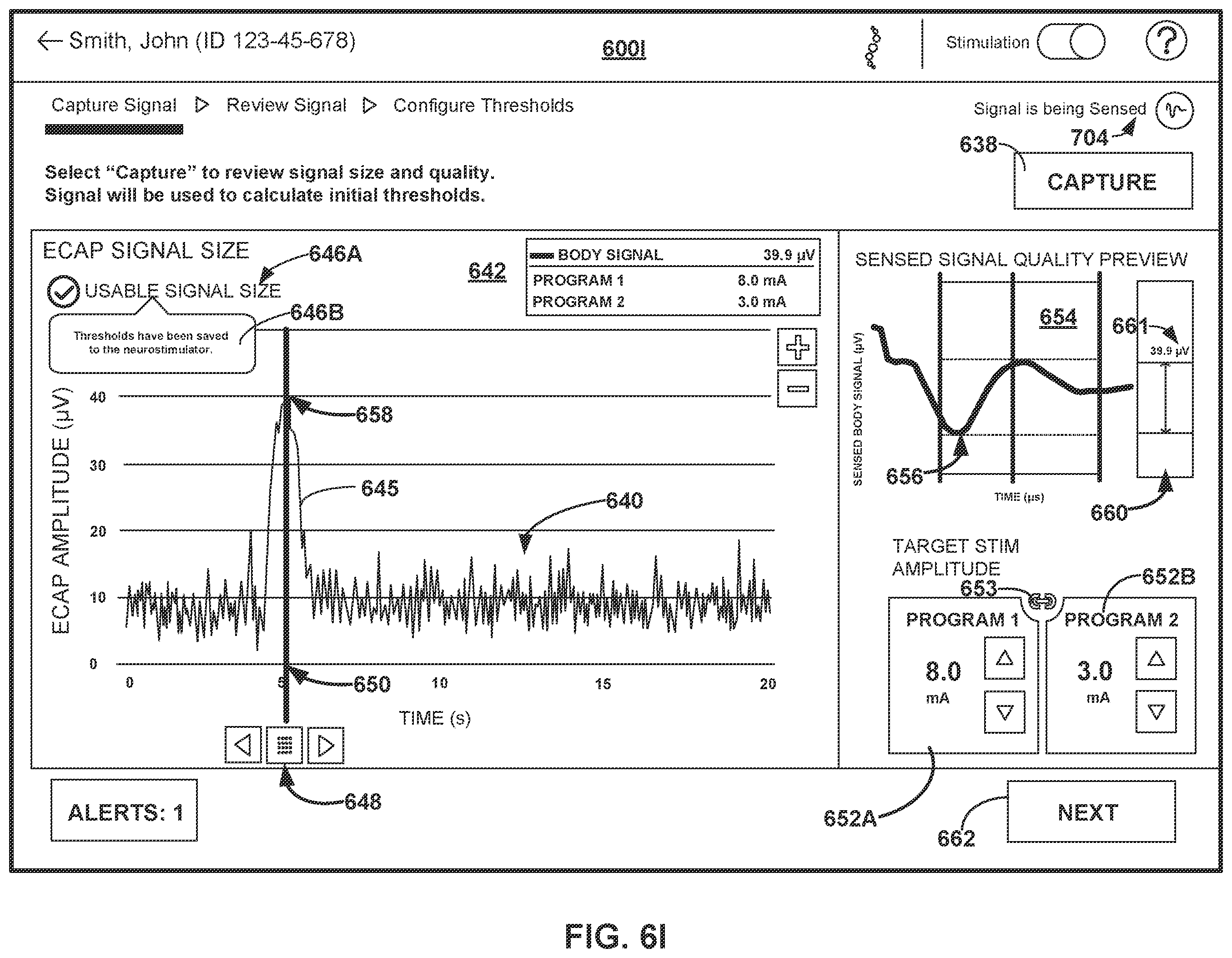 Patent US12508433 Figure 15 – Therapy programming based on evoked compound action potentials