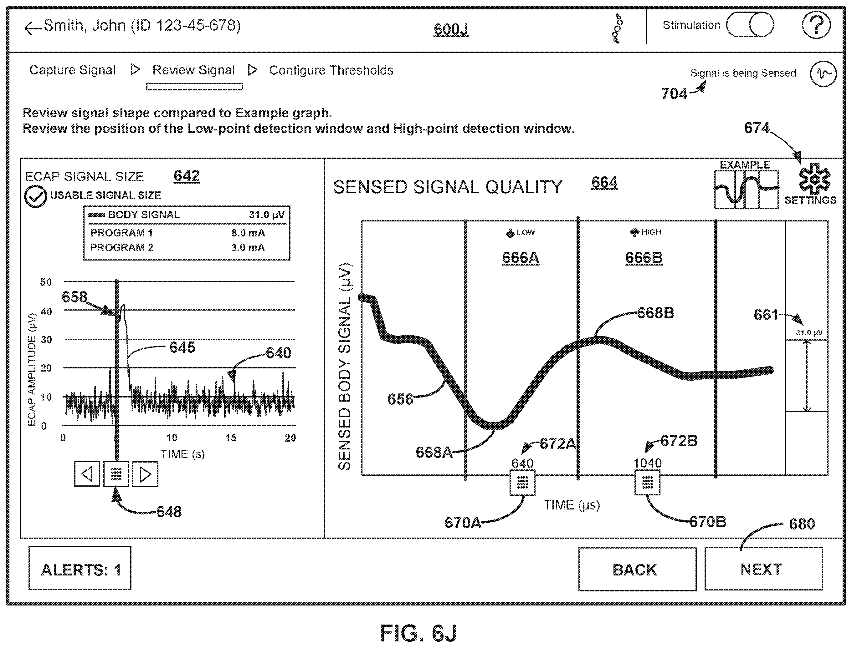 Patent US12508433 Figure 16 – Therapy programming based on evoked compound action potentials