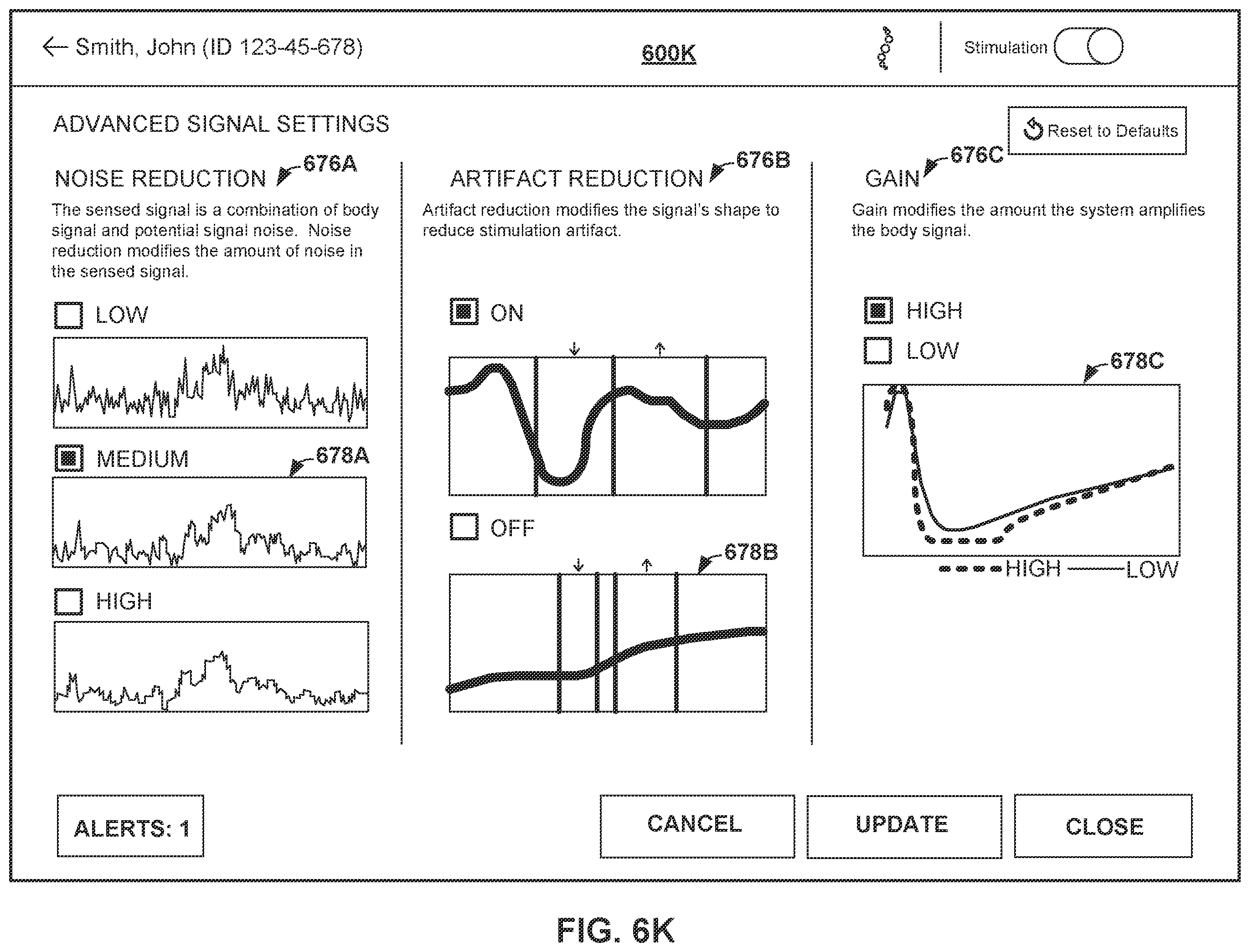 Patent US12508433 Figure 17 – Therapy programming based on evoked compound action potentials
