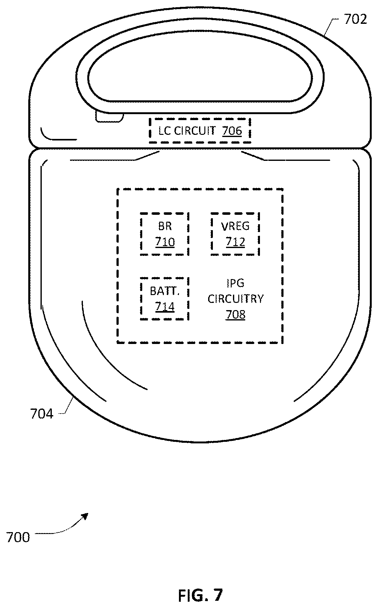 Patent US12508435 Figure 6 – Wireless power transfer circuit for a rechargeable implantable pulse generator