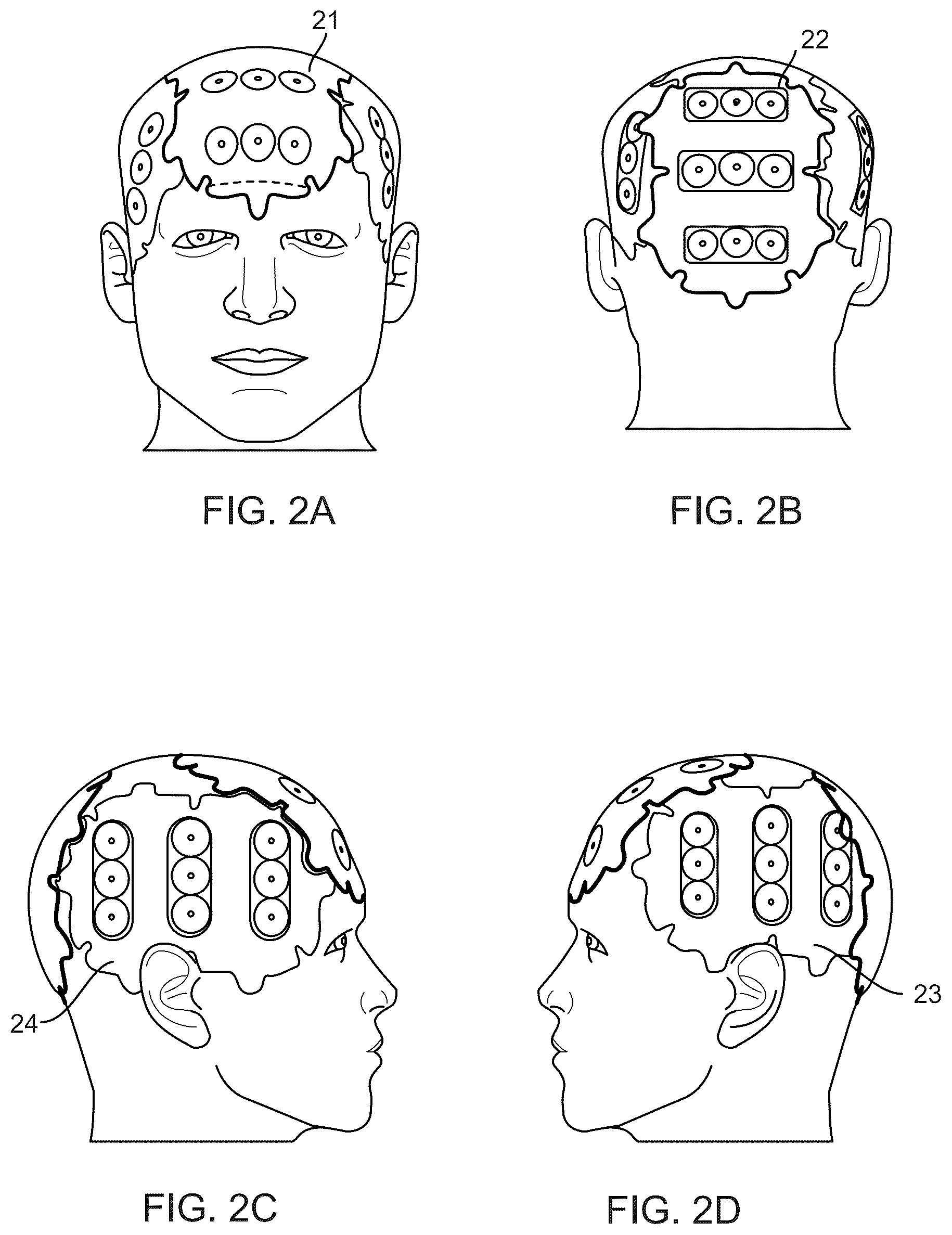 Patent US12508437 Figure 2 – Using capacitors to regulate current in transducer arrays for applying tumor treating fields (TTFields)