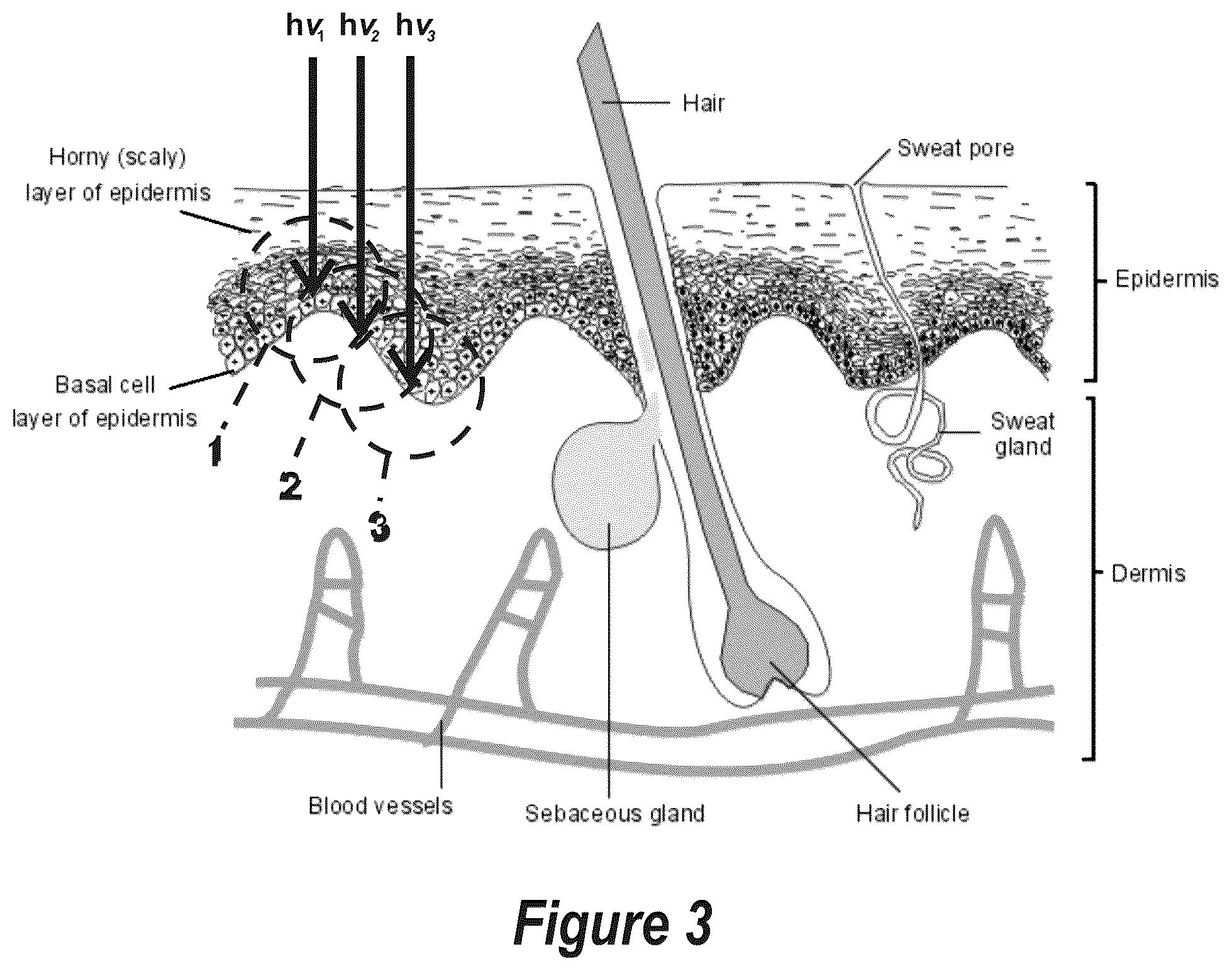 Patent US12508439 Figure 3 – Phototherapeutic light for treatment of pathogens