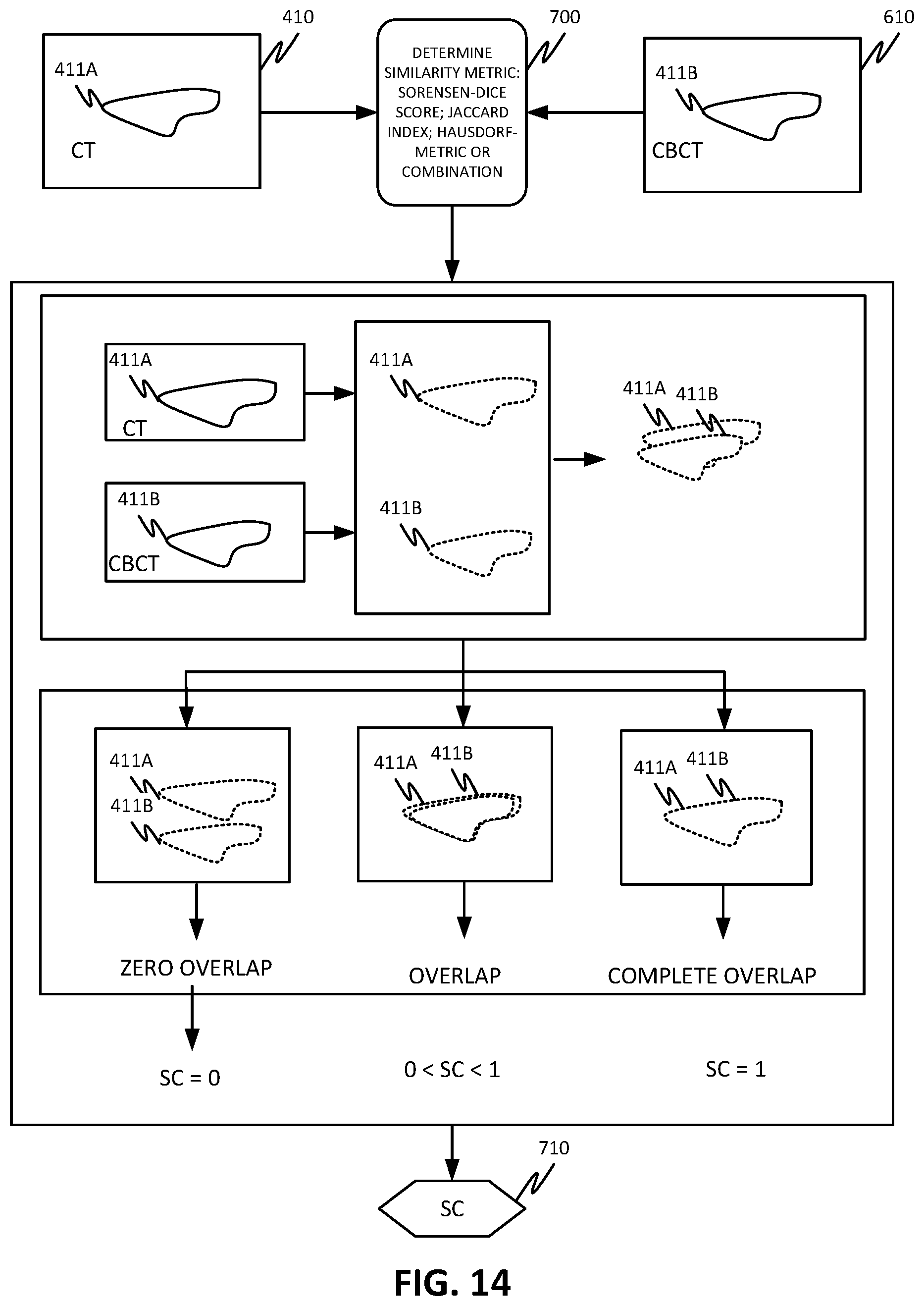 Patent US12508444 Figure 15 – Using organ similarity metric to determine optimization strategy in adaptive radiation therapy
