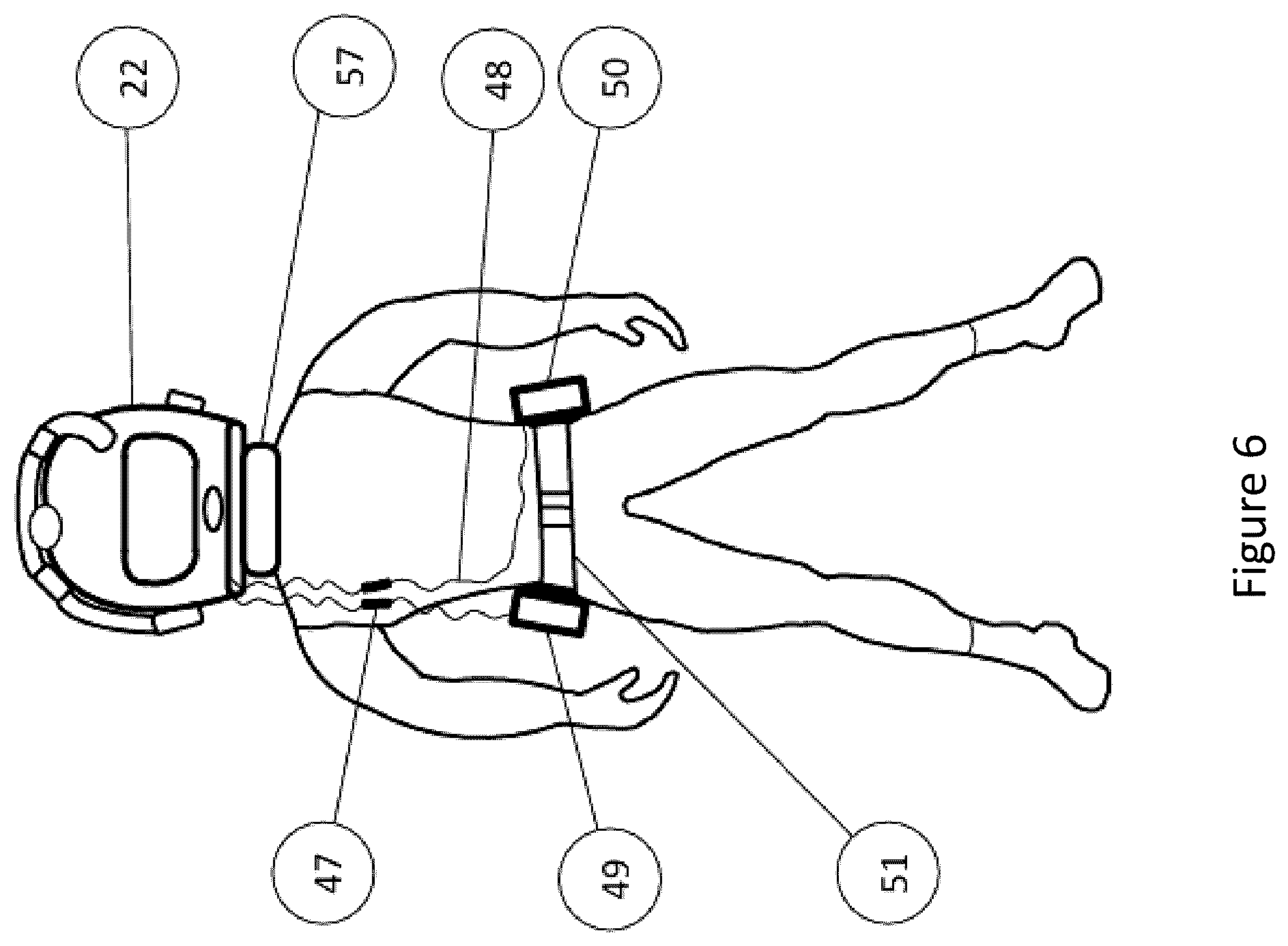 Patent US12508450 Figure 6 – Antiviral mobile respiratory personal protection device