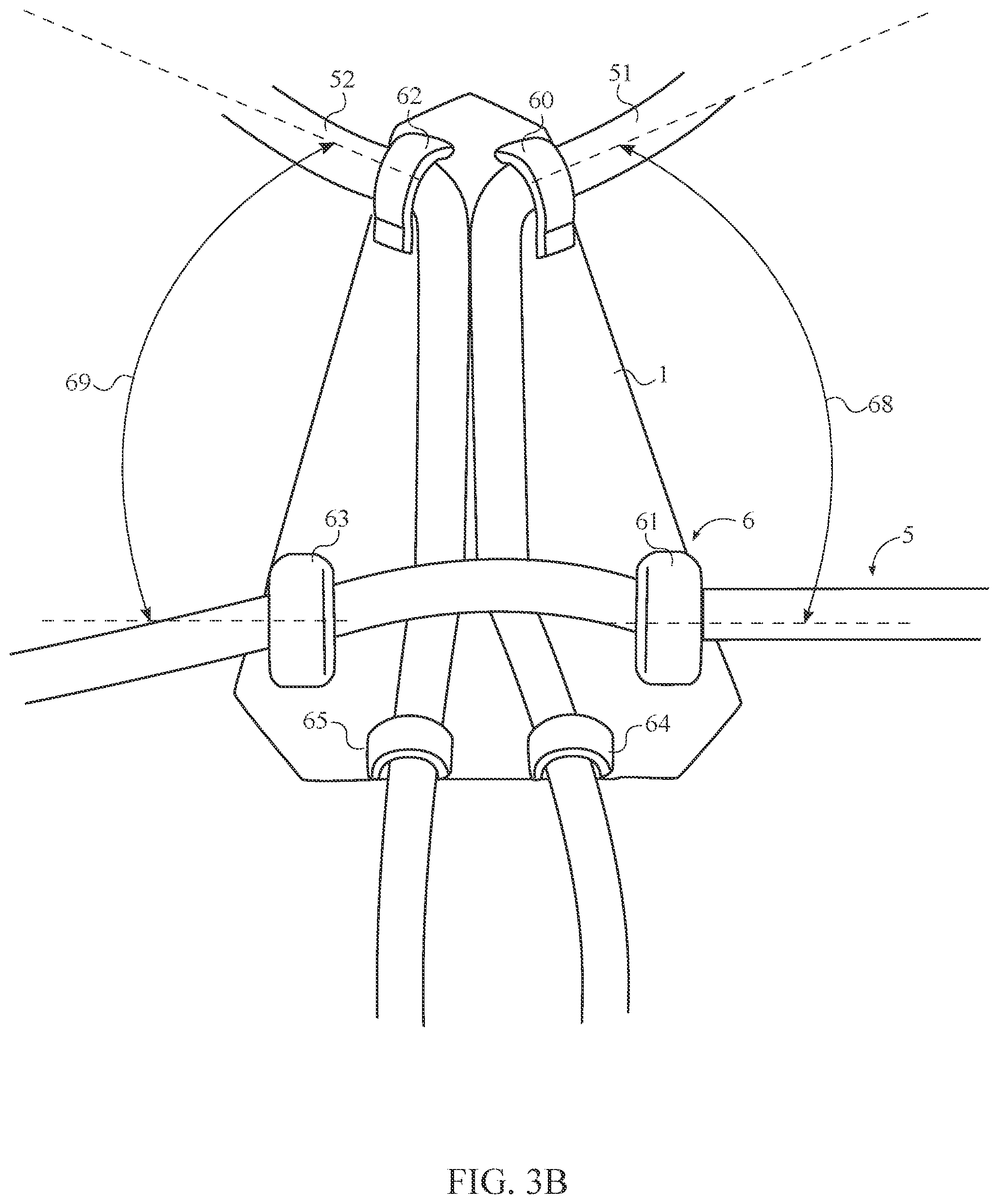 Patent US12508468 Figure 4 – Elastic resistance support