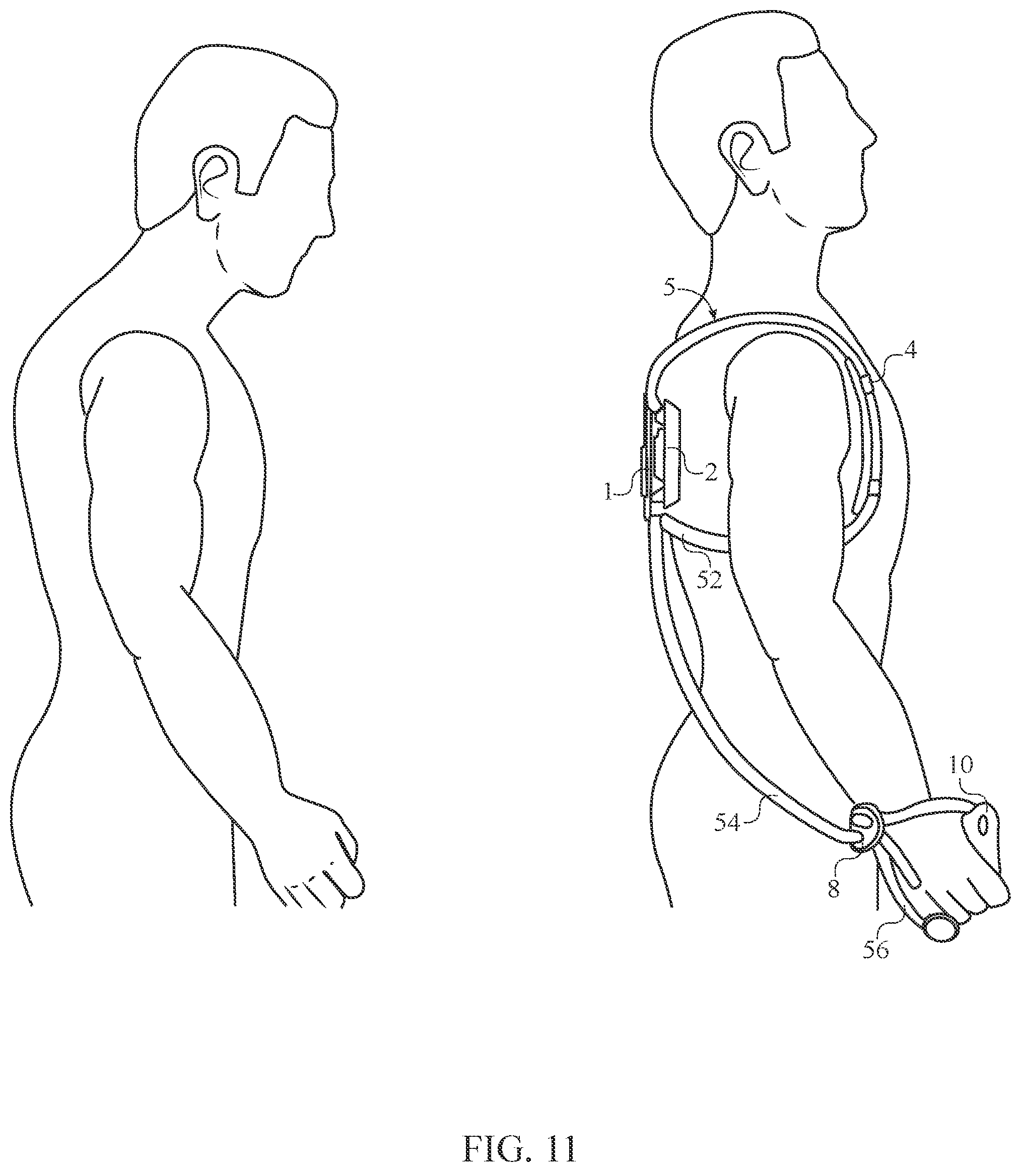 Patent US12508468 Figure 13 – Elastic resistance support