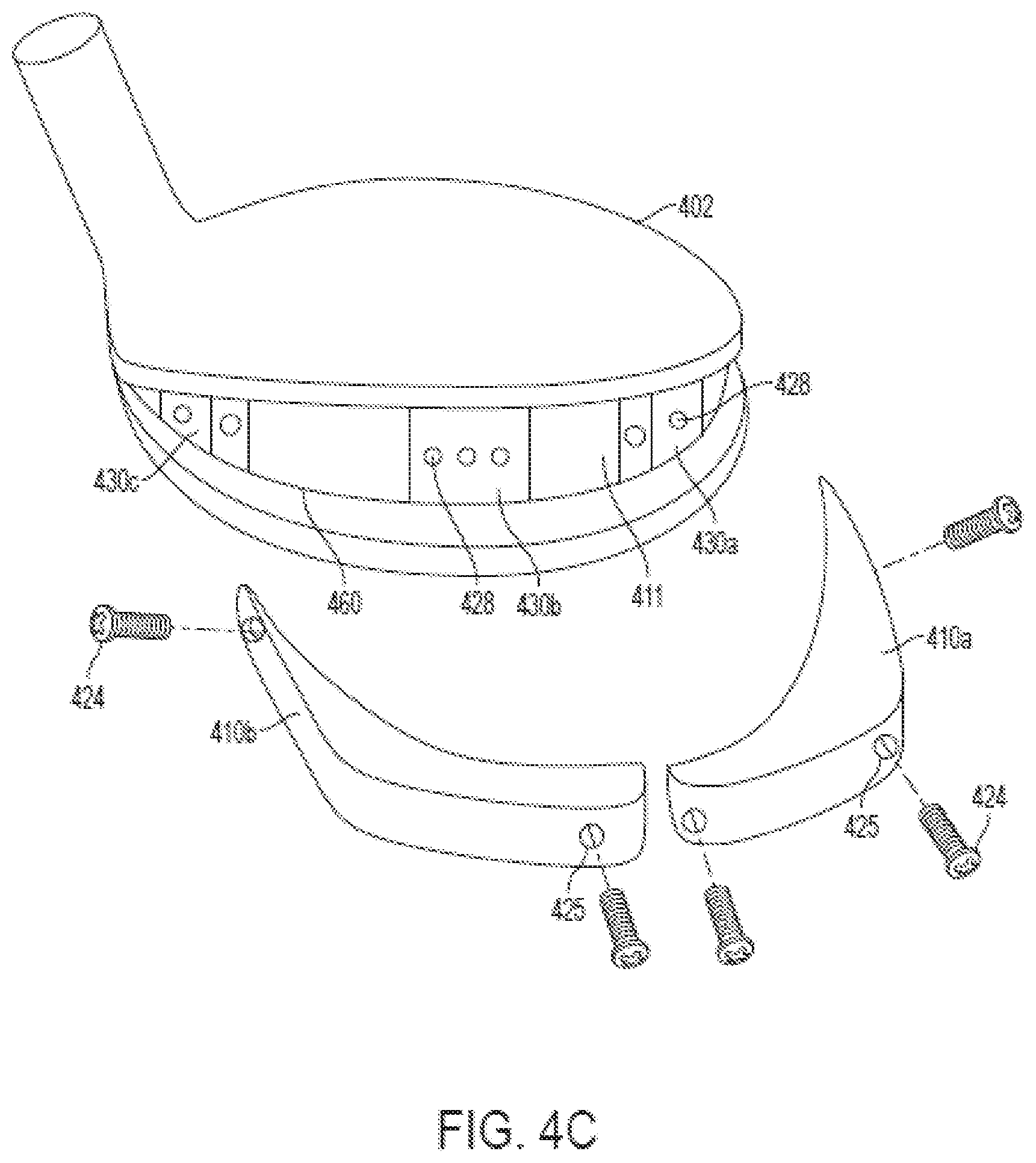 Patent US12508480 Figure 11 – Golf clubs and golf club heads having interchangeable rear body members