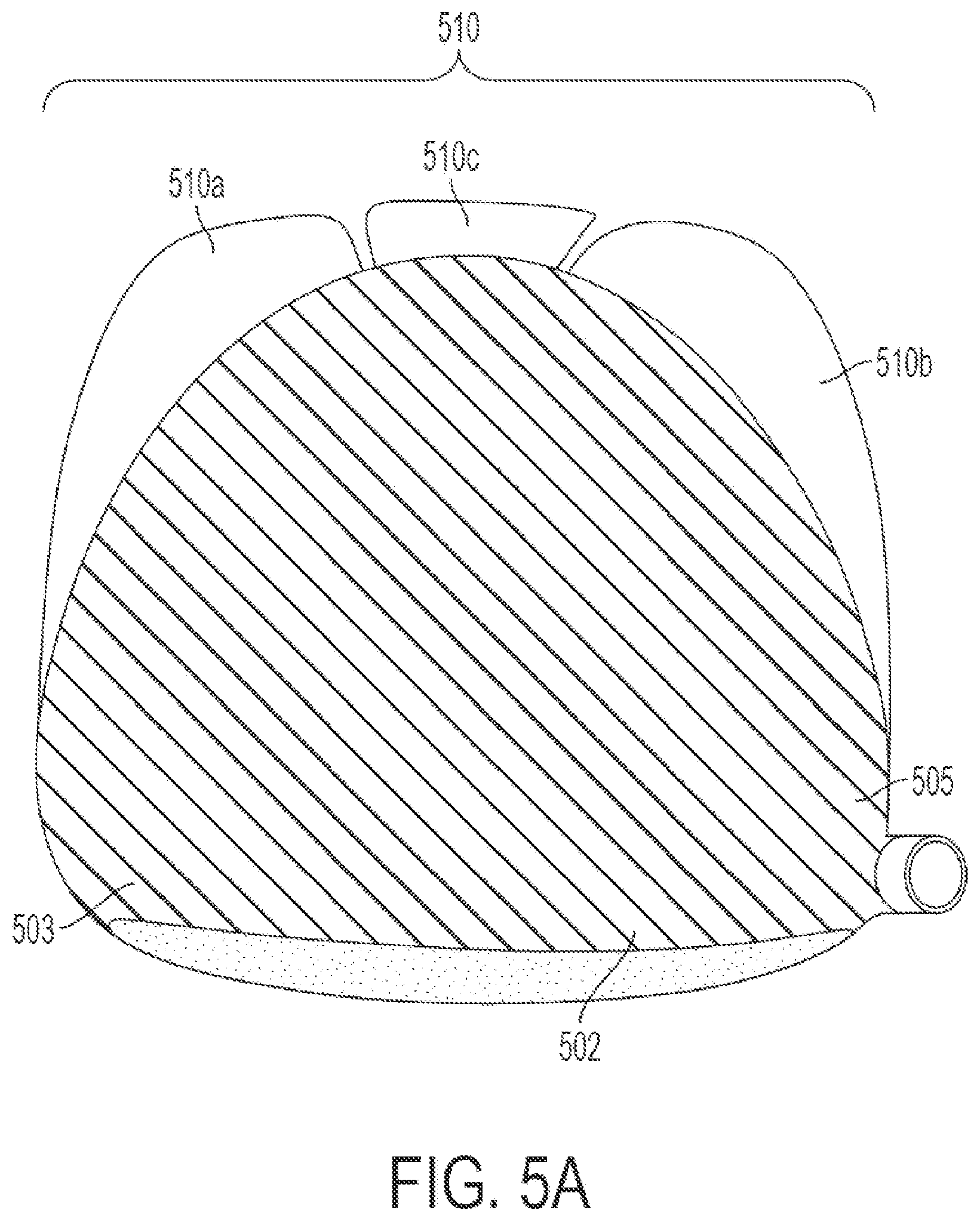 Patent US12508480 Figure 12 – Golf clubs and golf club heads having interchangeable rear body members