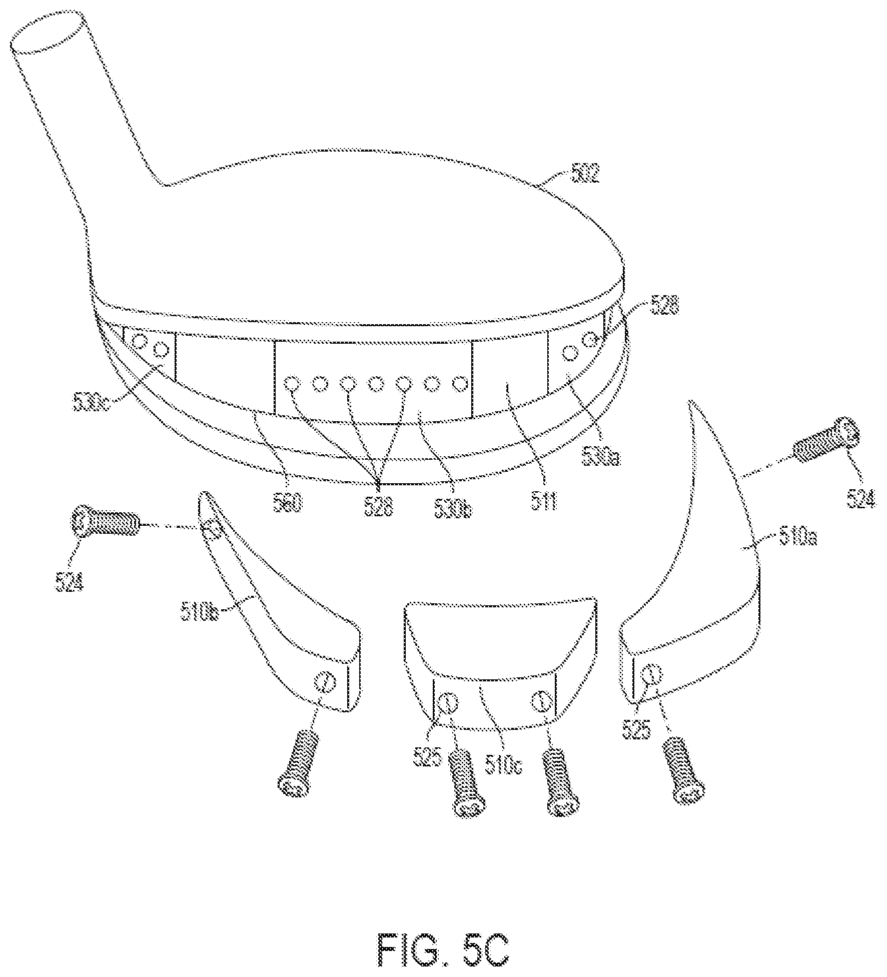 Patent US12508480 Figure 14 – Golf clubs and golf club heads having interchangeable rear body members