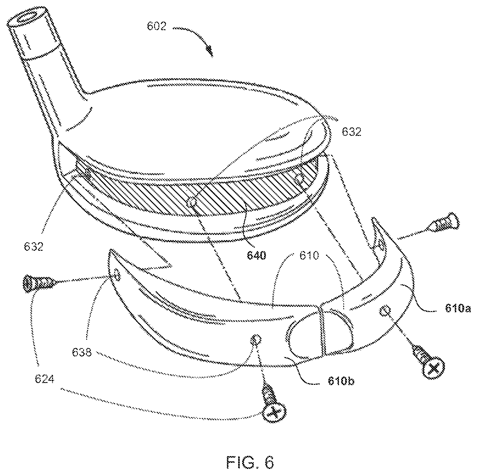 Patent US12508480 Figure 15 – Golf clubs and golf club heads having interchangeable rear body members