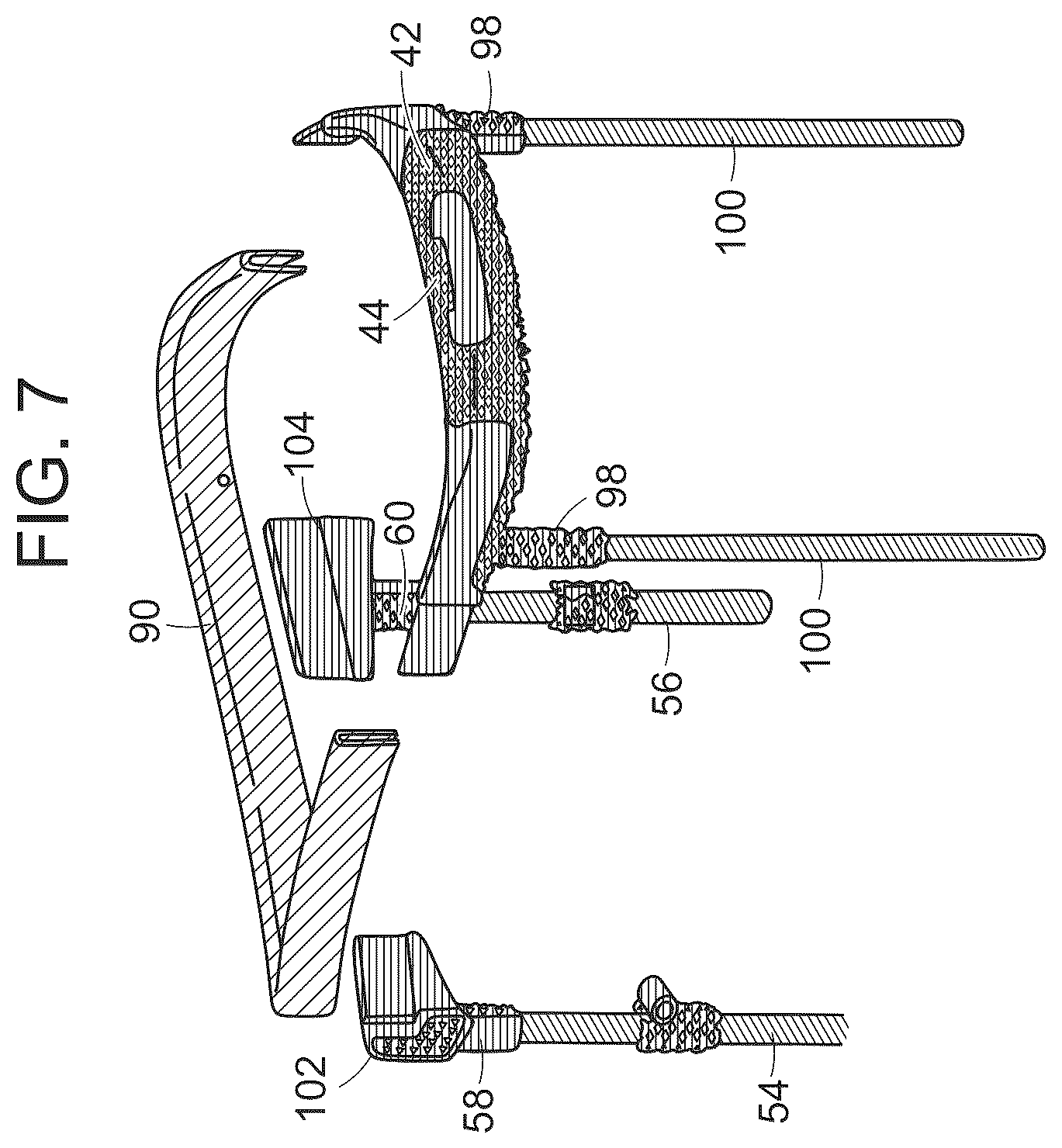 Patent US12508482 Figure 9 – Golf bag having lightweight top frame with three-dimensional printed structures