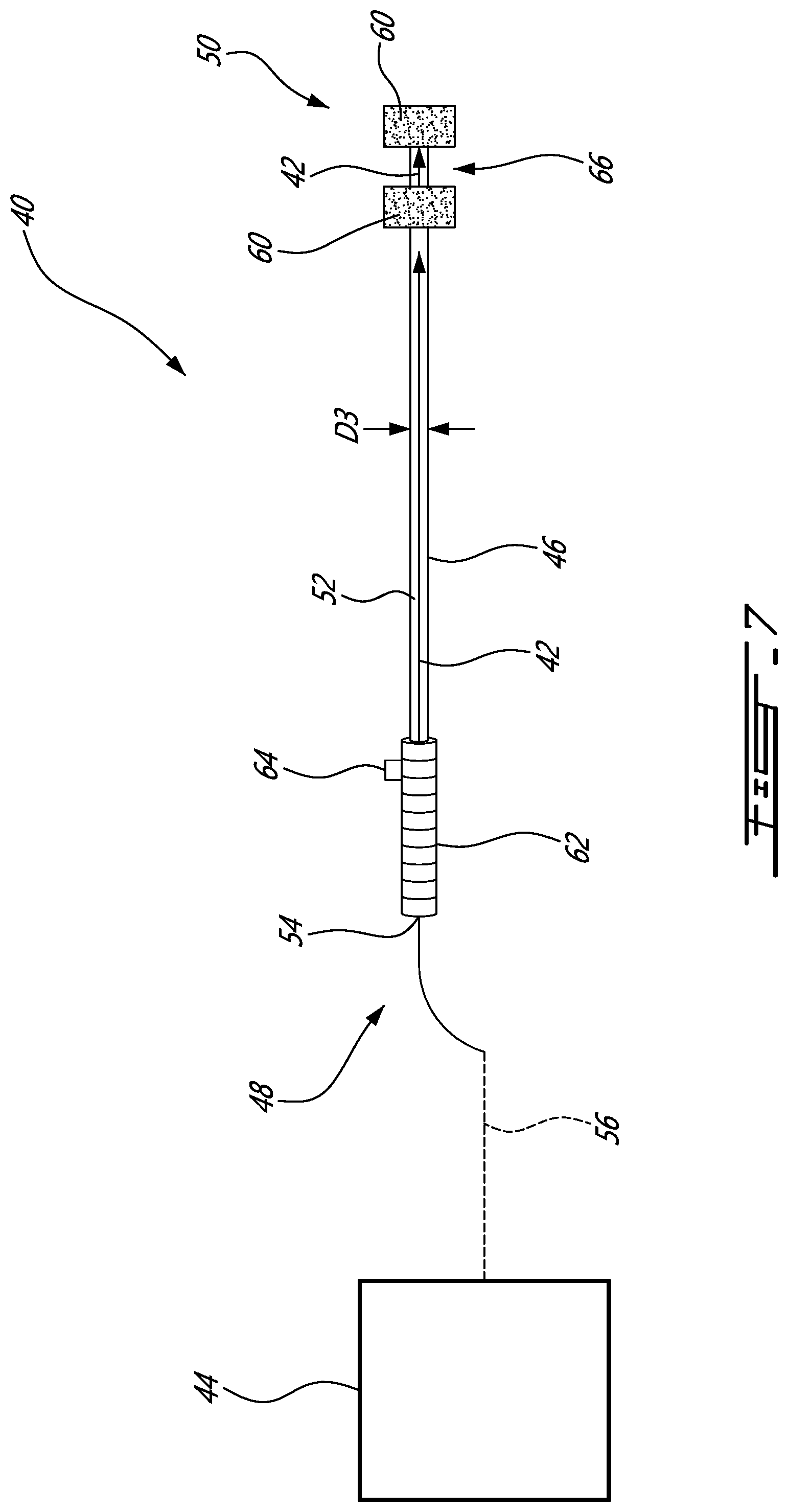 Patent US12508622 Figure 7 – Internal surface treatment device for hollow engine shaft and the like