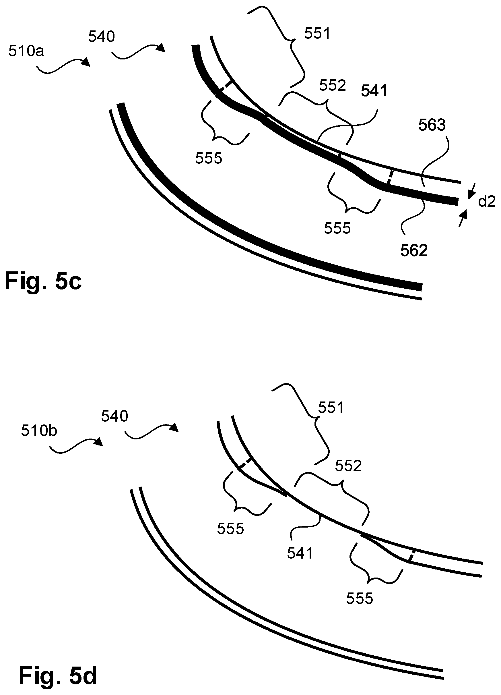 Patent US12508653 Figure 4 – Method for manufacturing an impeller