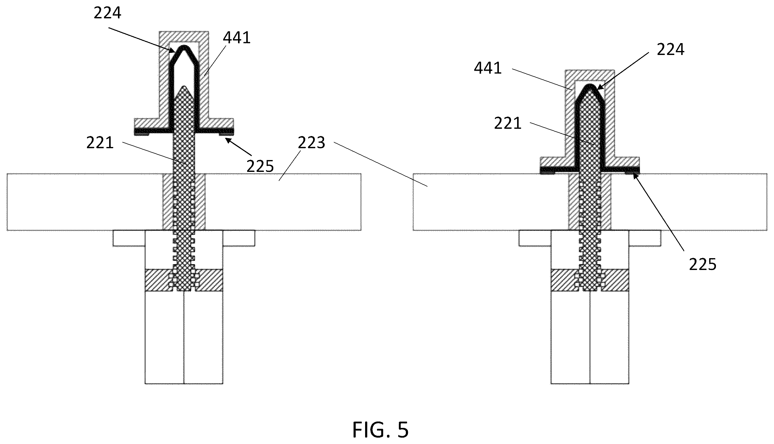 Patent US12508743 Figure 5 – In-mold sealing system to assist with vacuum assisted resin transfer molding