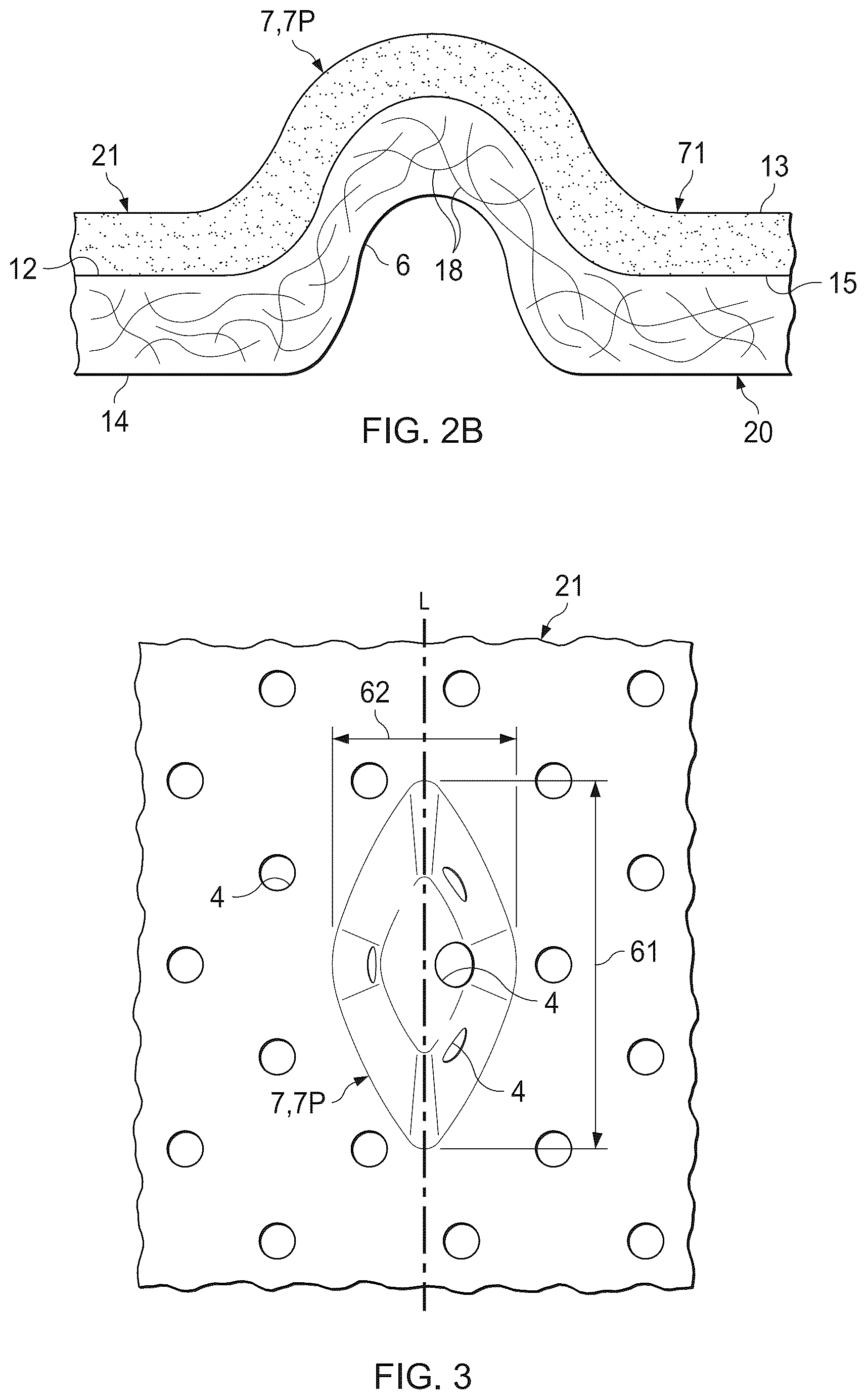 Patent US12508761 Figure 2 – Laminate webs and absorbent articles having the same
