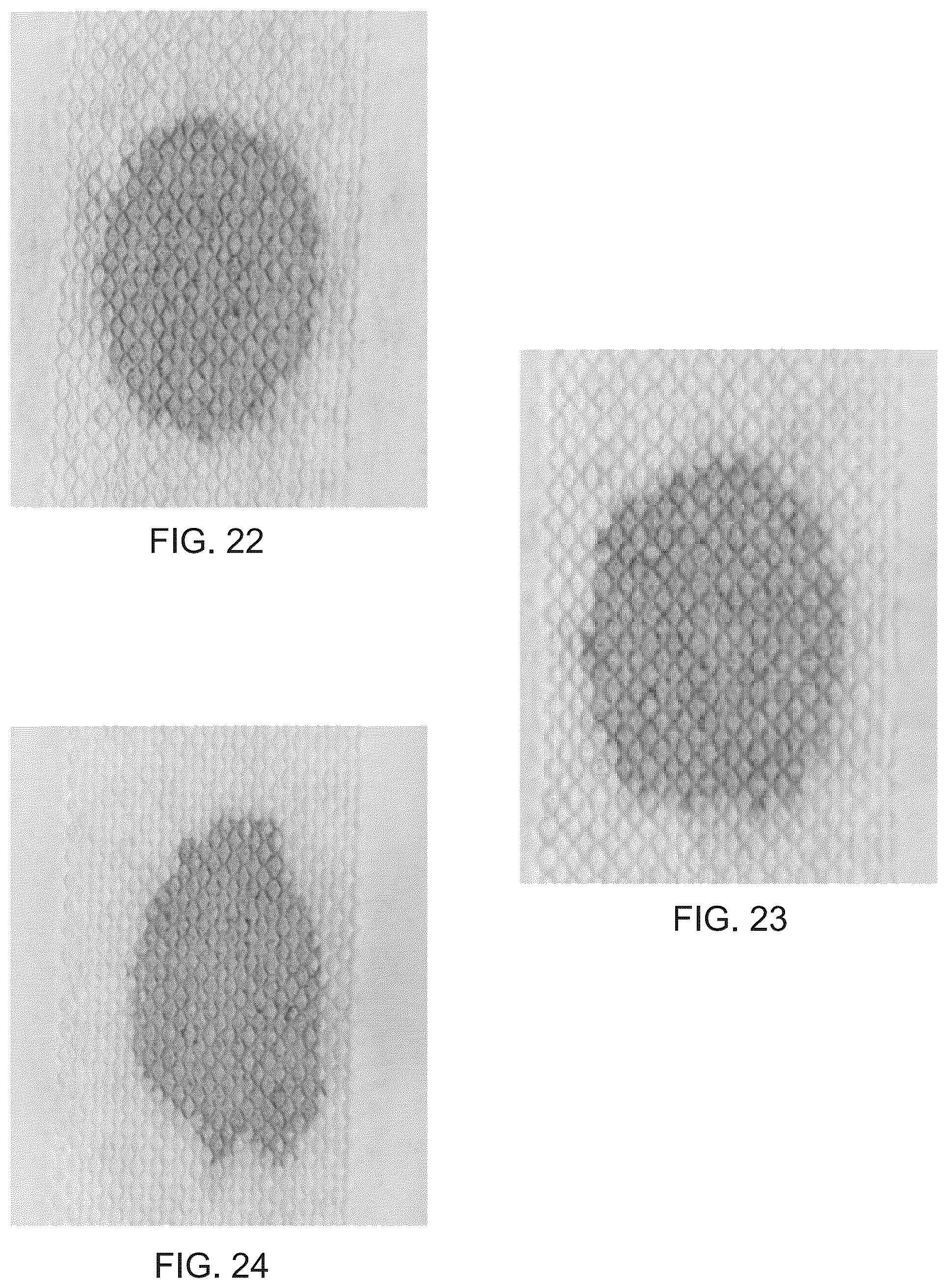 Patent US12508761 Figure 20 – Laminate webs and absorbent articles having the same