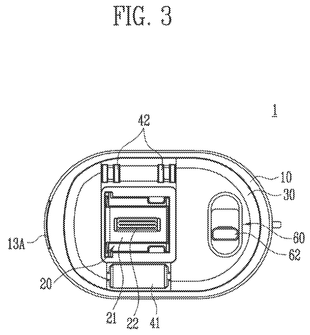 Patent US12508820 Figure 3 – Portable printer and portable printing system