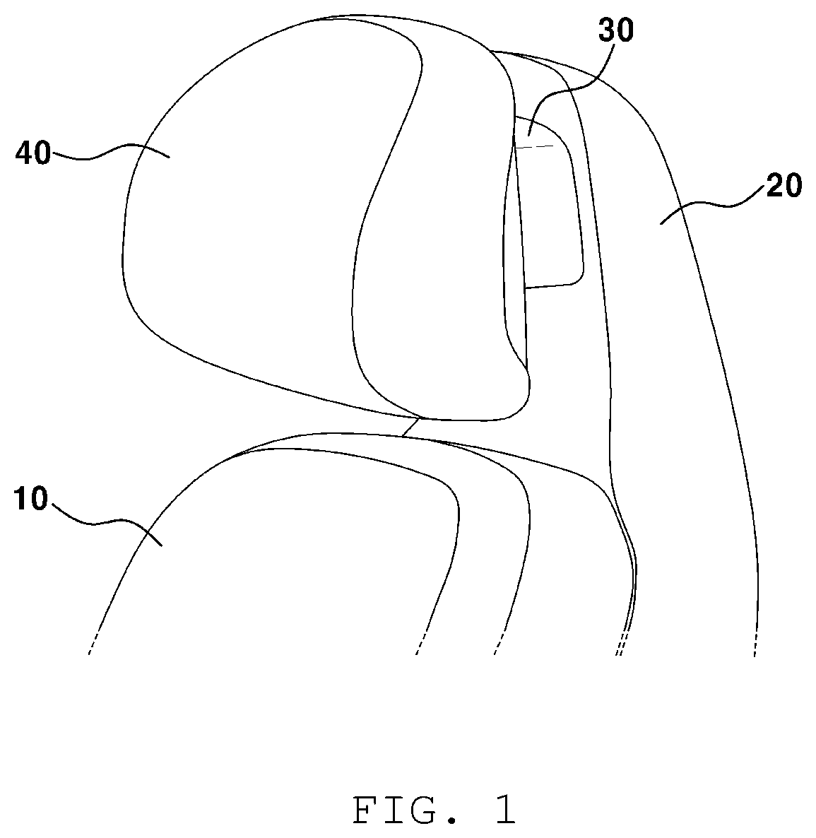 Patent US12508965 Figure 1 – Device for adjusting position of vehicle headrest