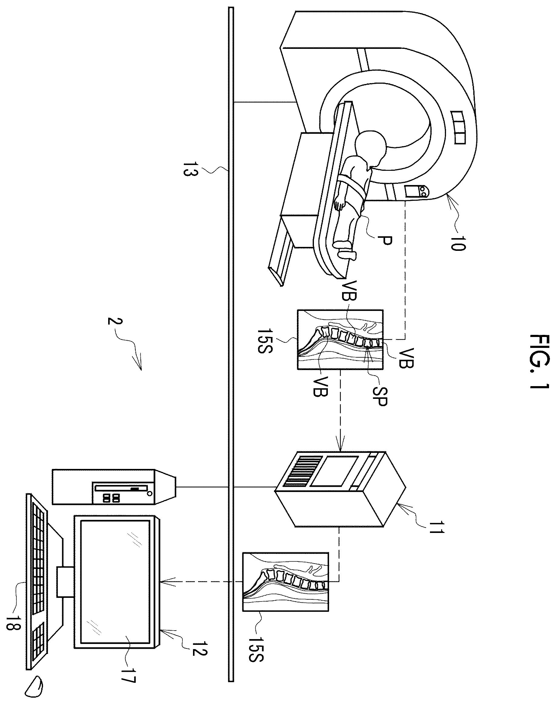 Patent US12511756 — Image processing apparatus, operation method of image processing apparatus, operation program of image processing apparatus, and learning method — Figure 1