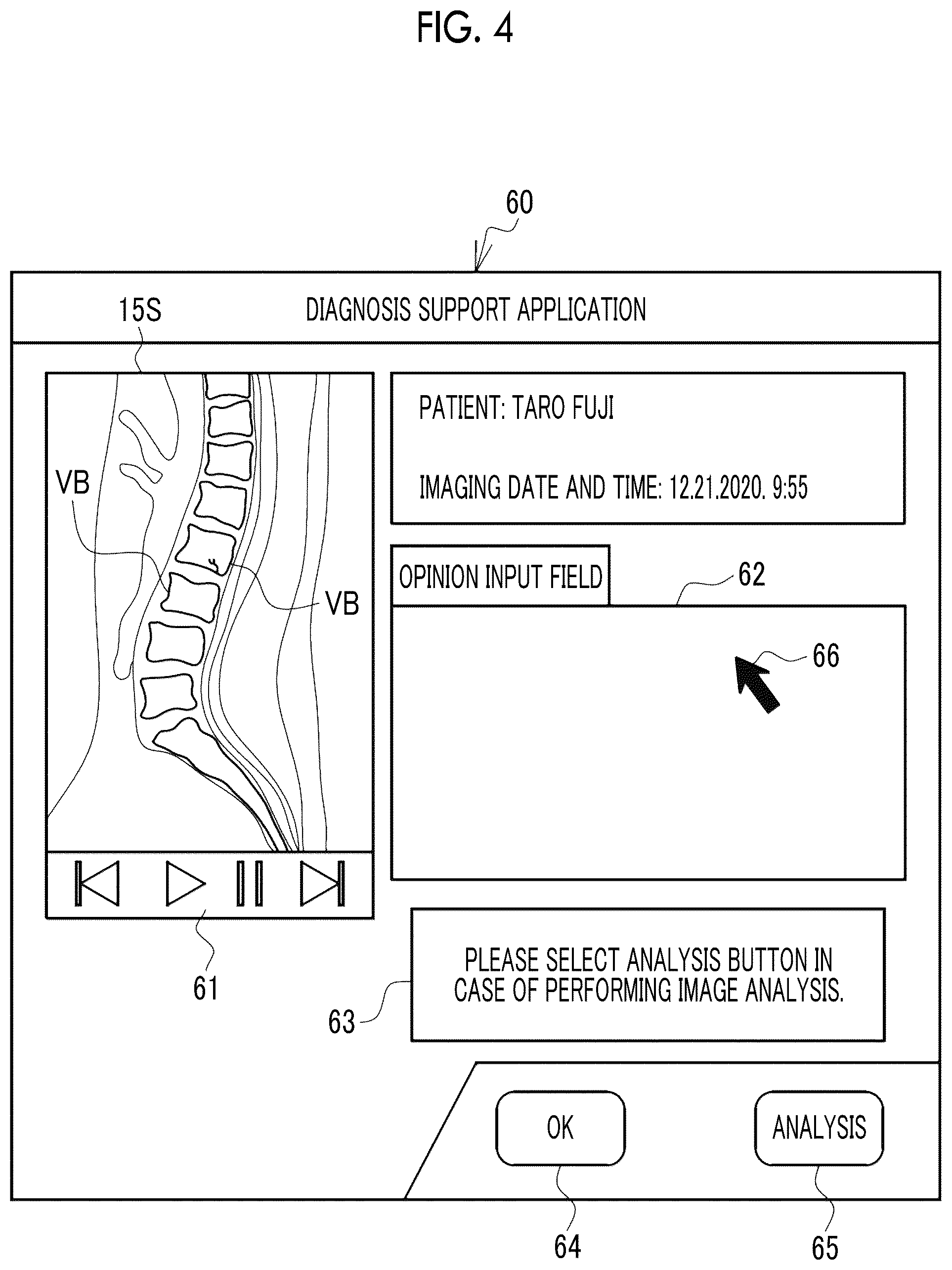 Patent US12511756 Figure 4 – Image processing apparatus, operation method of image processing apparatus, operation program of image processing apparatus, and learning method