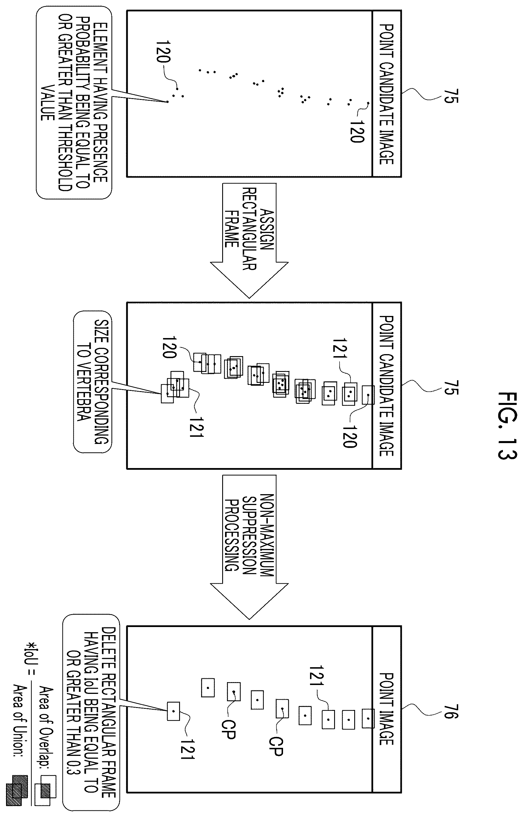 Patent US12511756 Figure 11 – Image processing apparatus, operation method of image processing apparatus, operation program of image processing apparatus, and learning method