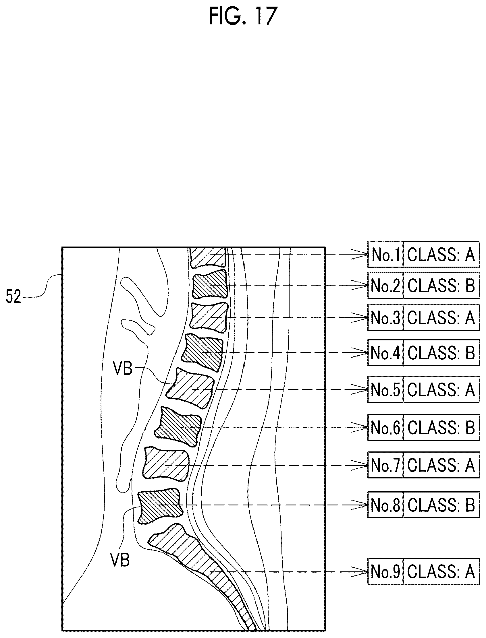 Patent US12511756 Figure 15 – Image processing apparatus, operation method of image processing apparatus, operation program of image processing apparatus, and learning method