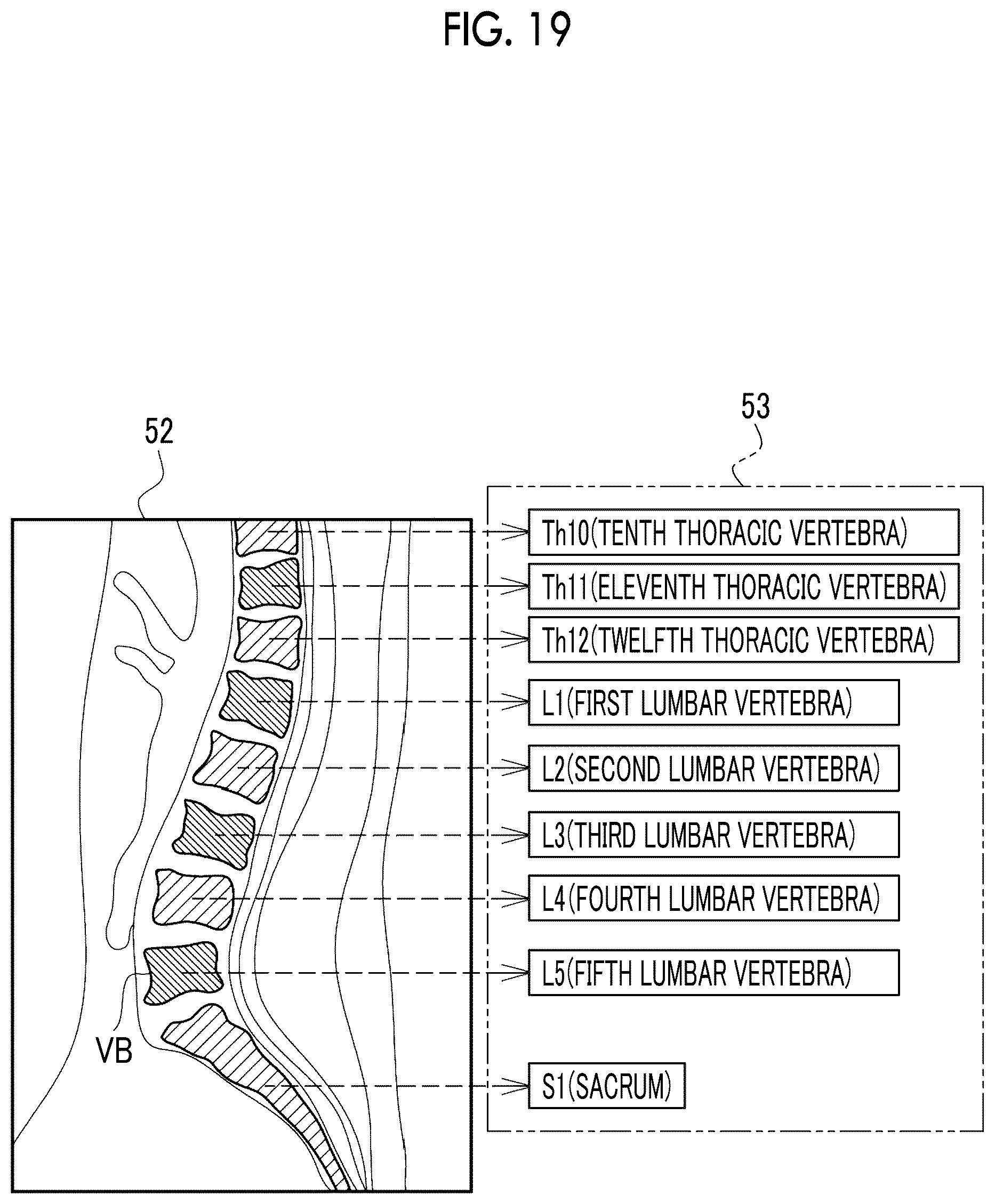 Patent US12511756 Figure 17 – Image processing apparatus, operation method of image processing apparatus, operation program of image processing apparatus, and learning method