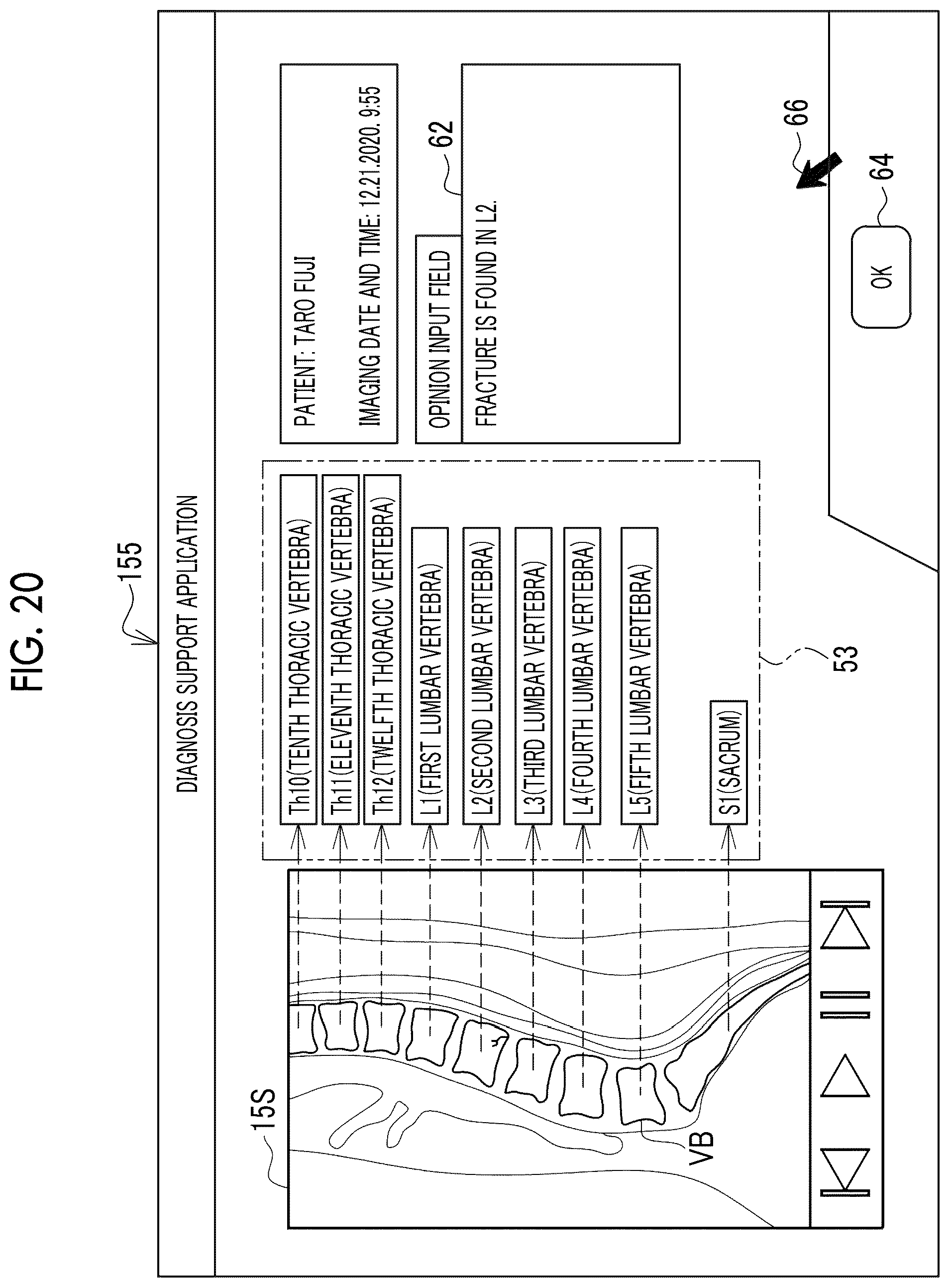 Patent US12511756 Figure 18 – Image processing apparatus, operation method of image processing apparatus, operation program of image processing apparatus, and learning method