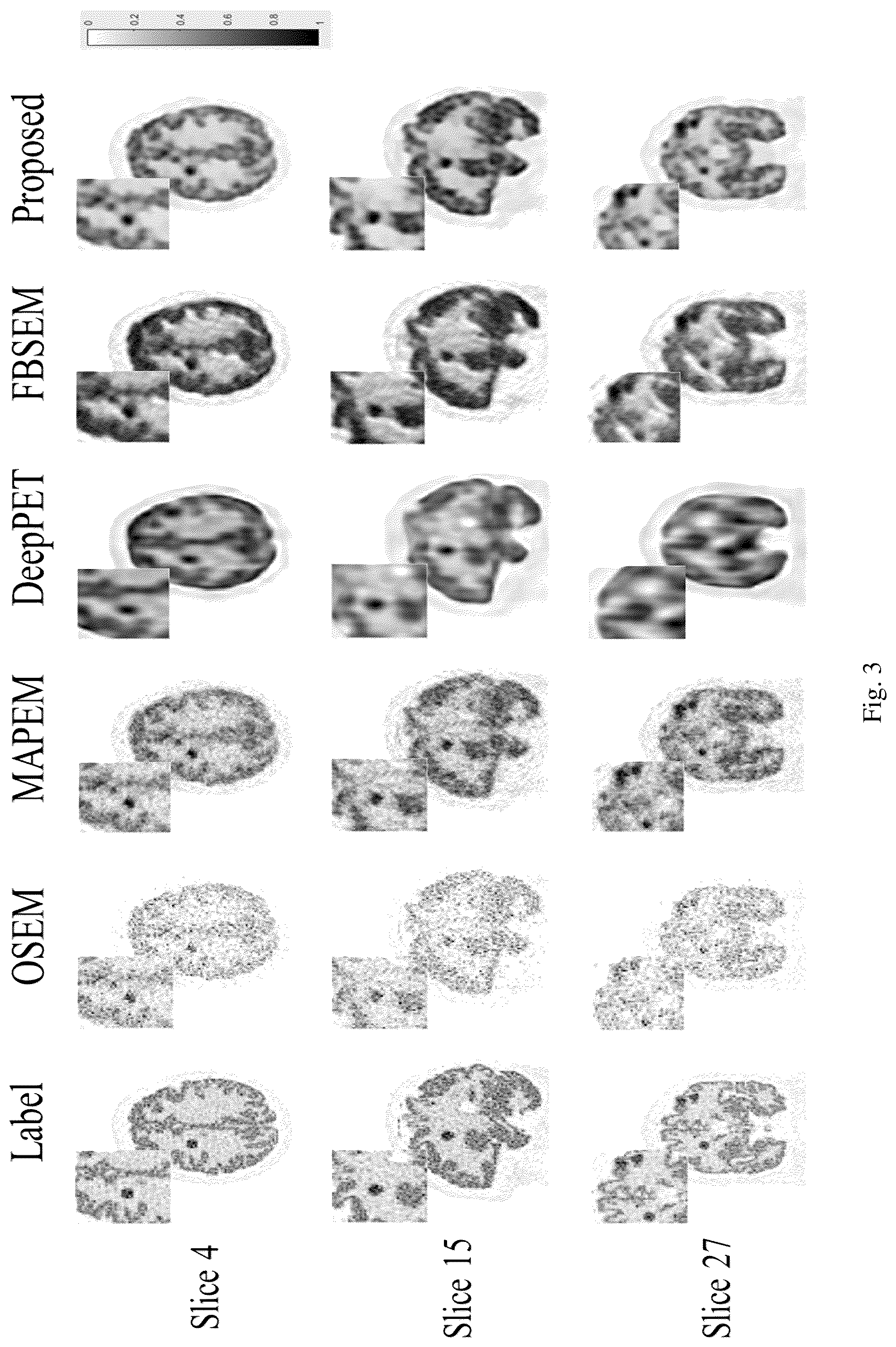 Patent US12511799 Figure 3 – Pet image reconstruction method based on swin-transformer regularization