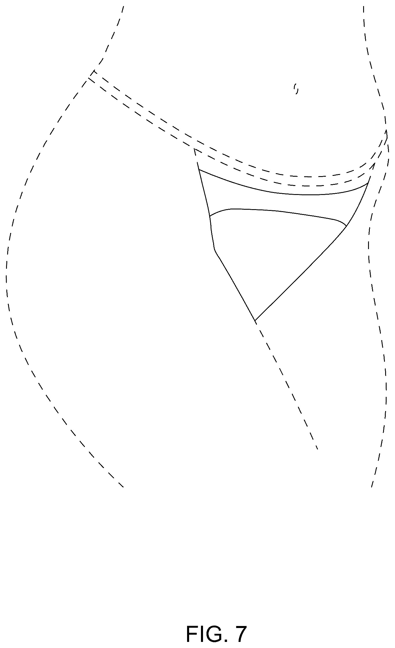 Patent USD1075217 Figure 7 – Garment with body shape enhancing apparatus