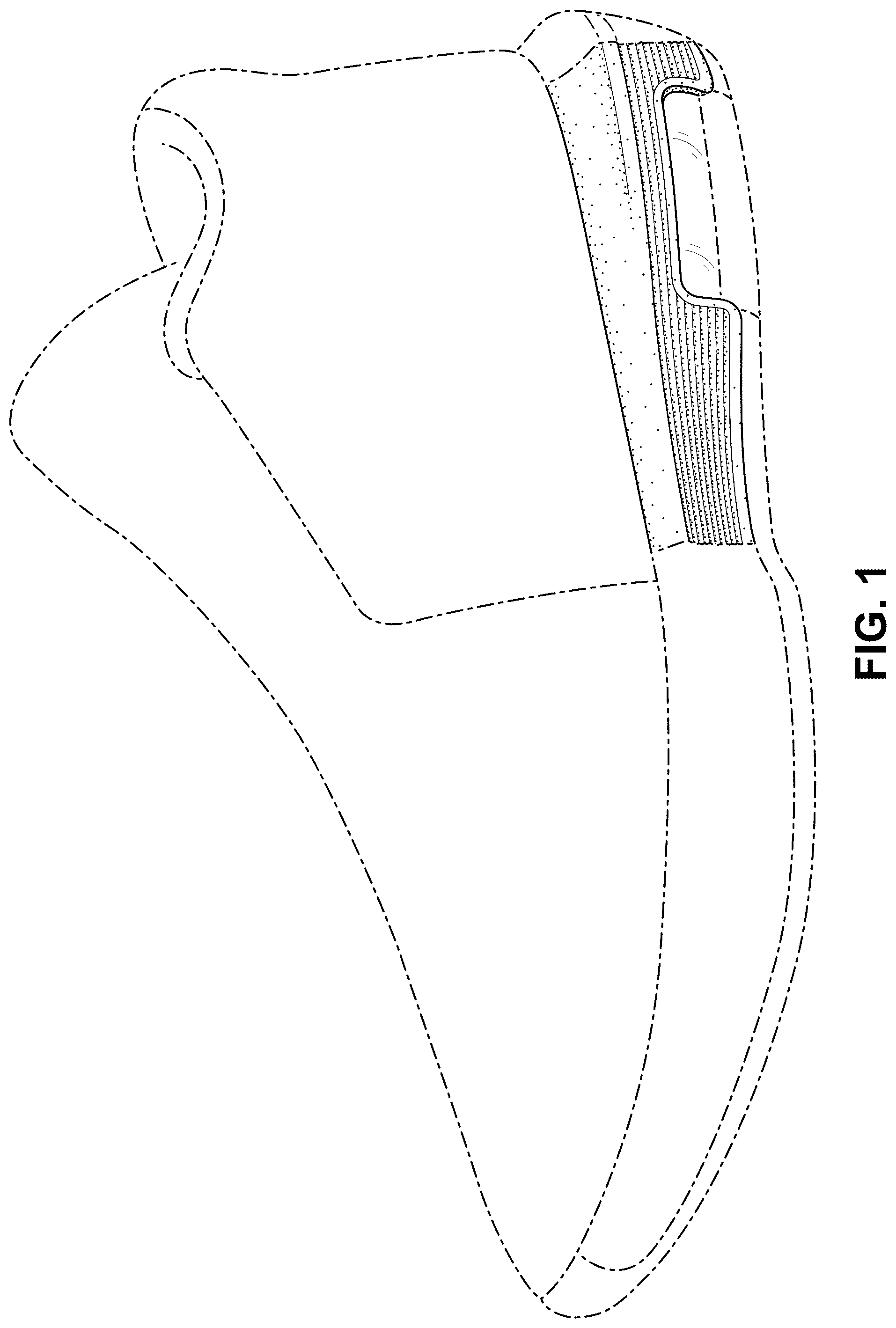 Patent USD1075248 Figure 1 – Shoe