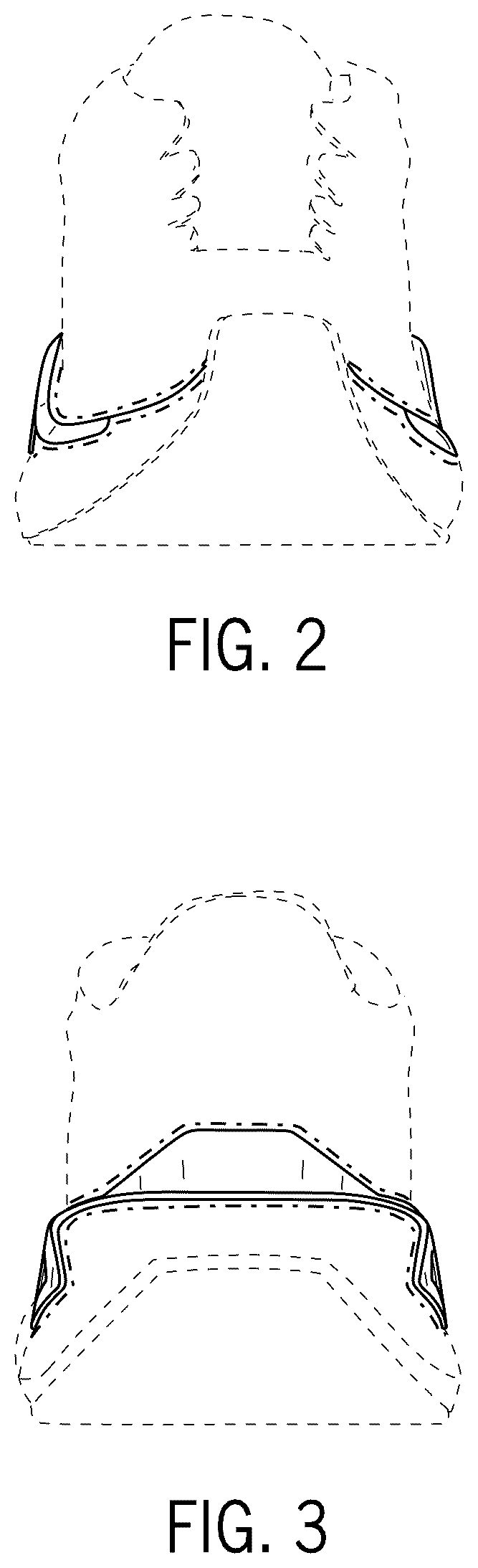 Patent USD1075253 Figure 2 – Footwear article