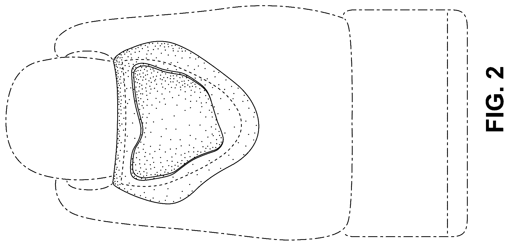 Patent USD1075270 Figure 2 – Shoe