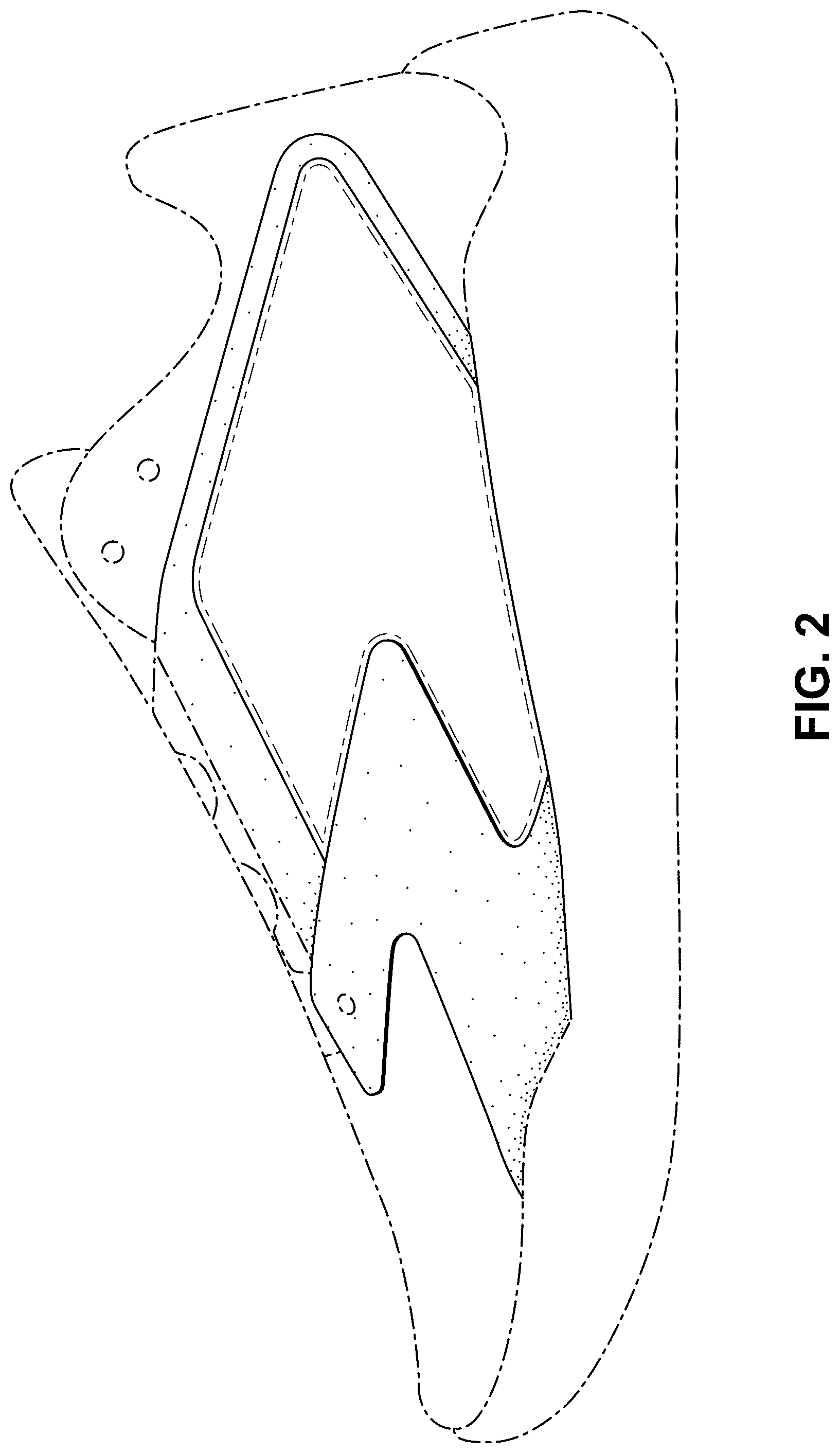 Patent USD1075273 Figure 2 – Shoe