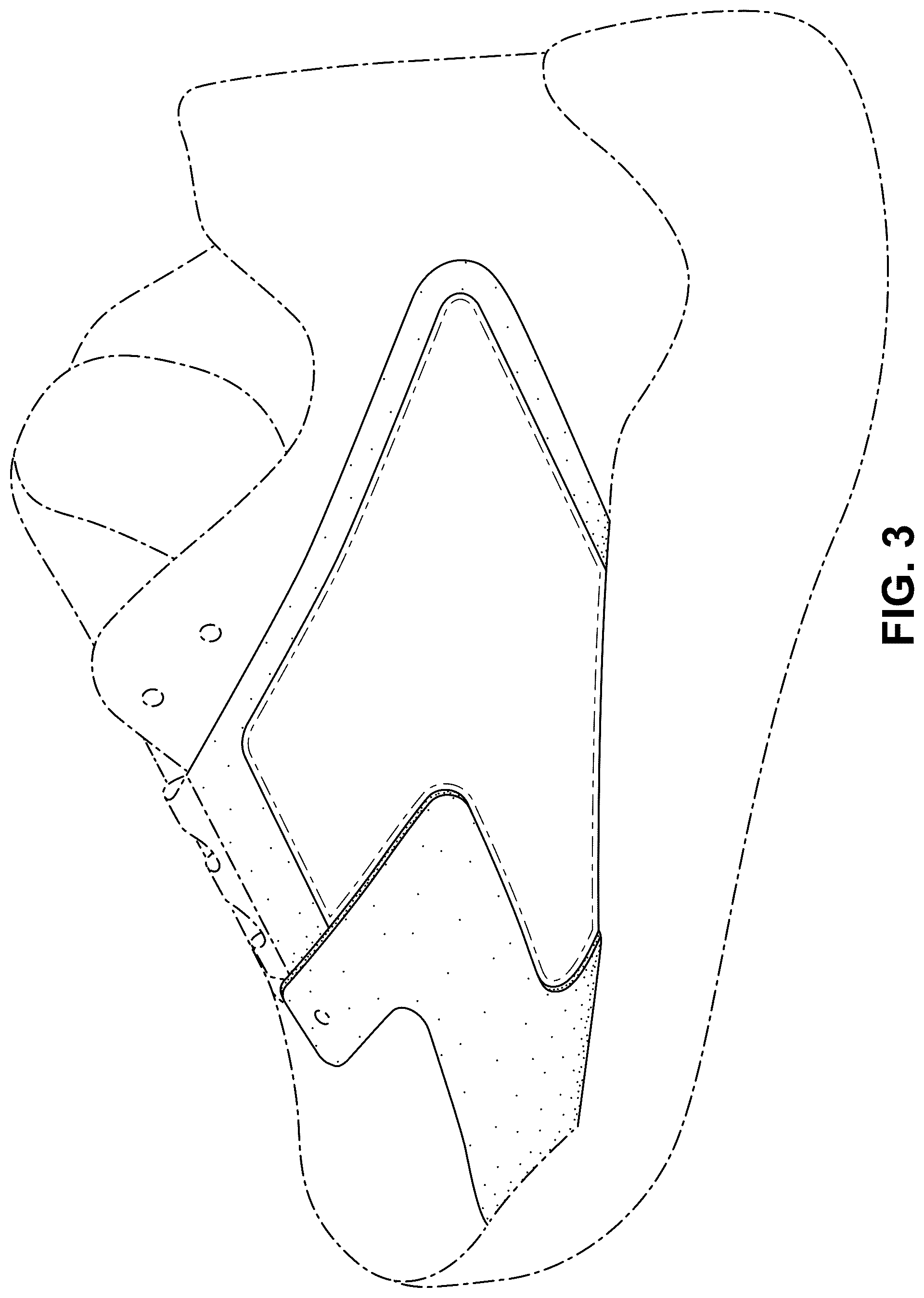 Patent USD1075273 Figure 3 – Shoe