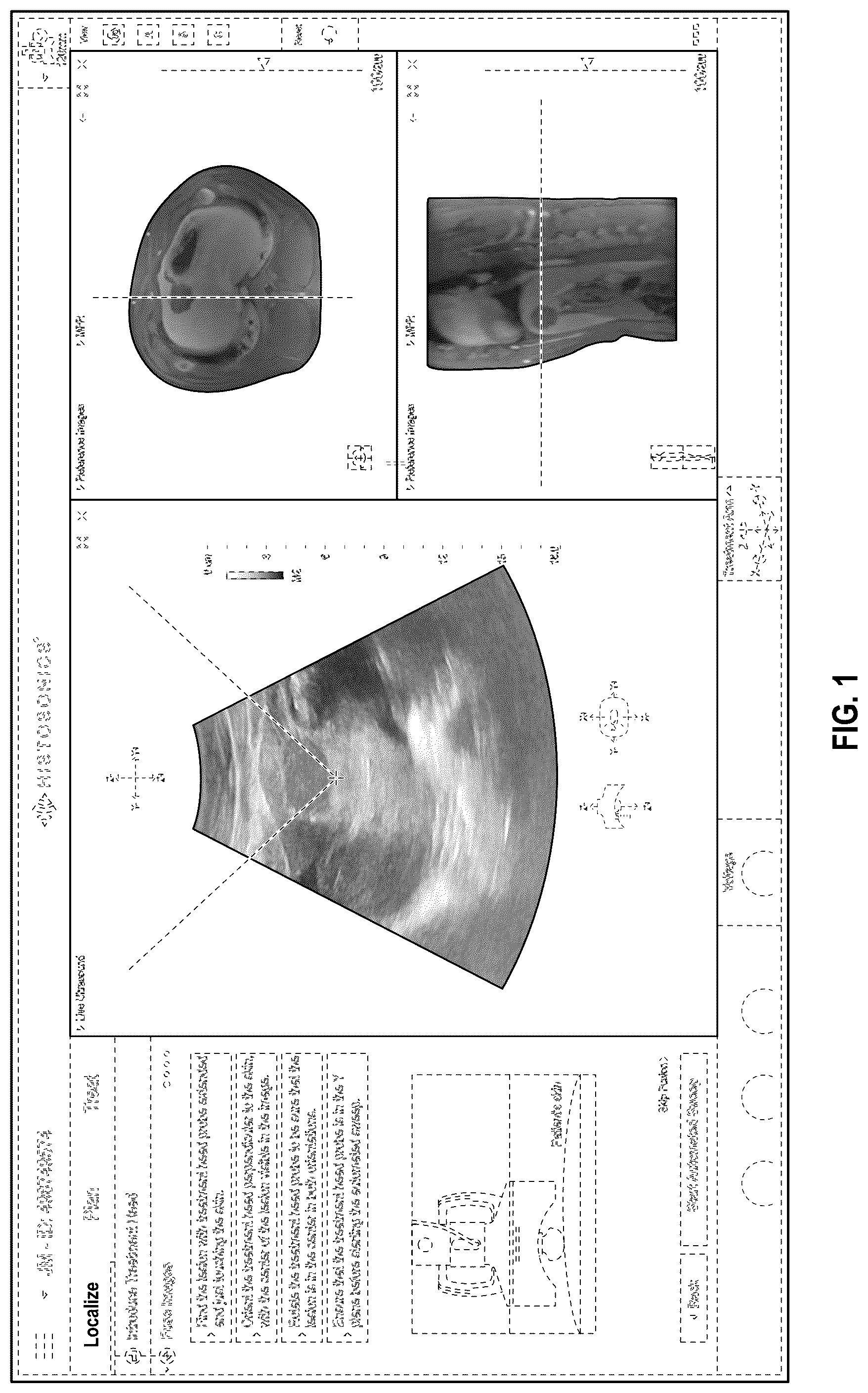 Patent USD1075796 Figure 1 – Display screen or portion thereof with an animated graphical user interface