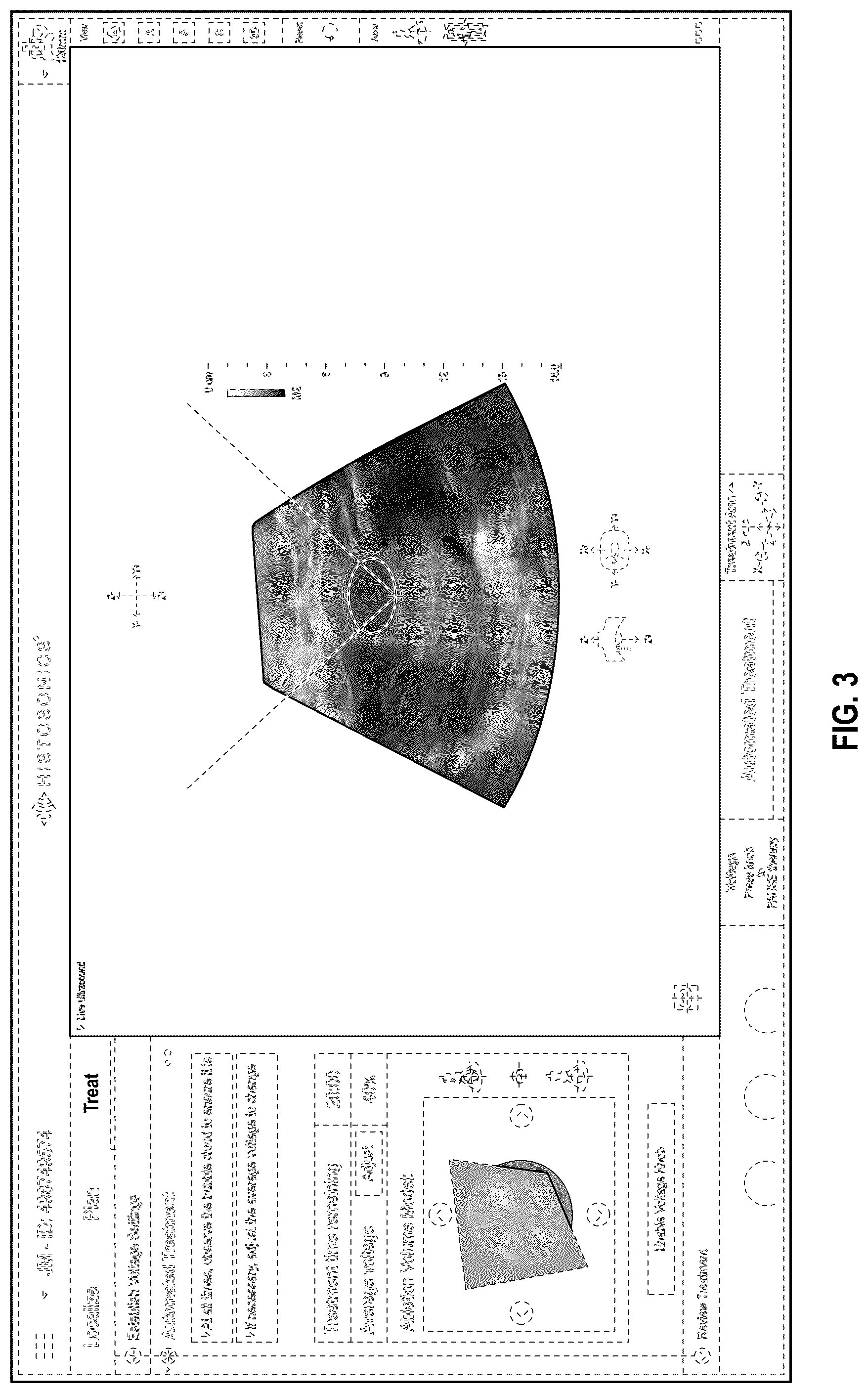 Patent USD1075796 Figure 3 – Display screen or portion thereof with an animated graphical user interface