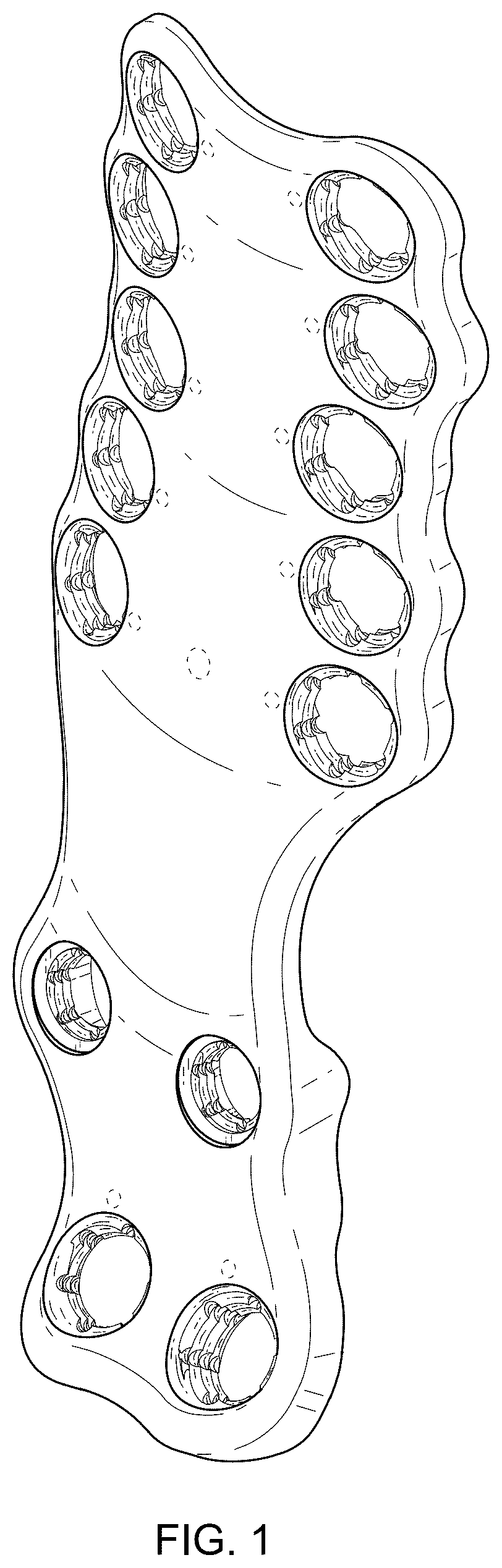 Patent USD1076090 Figure 1 – Straddle bone plate