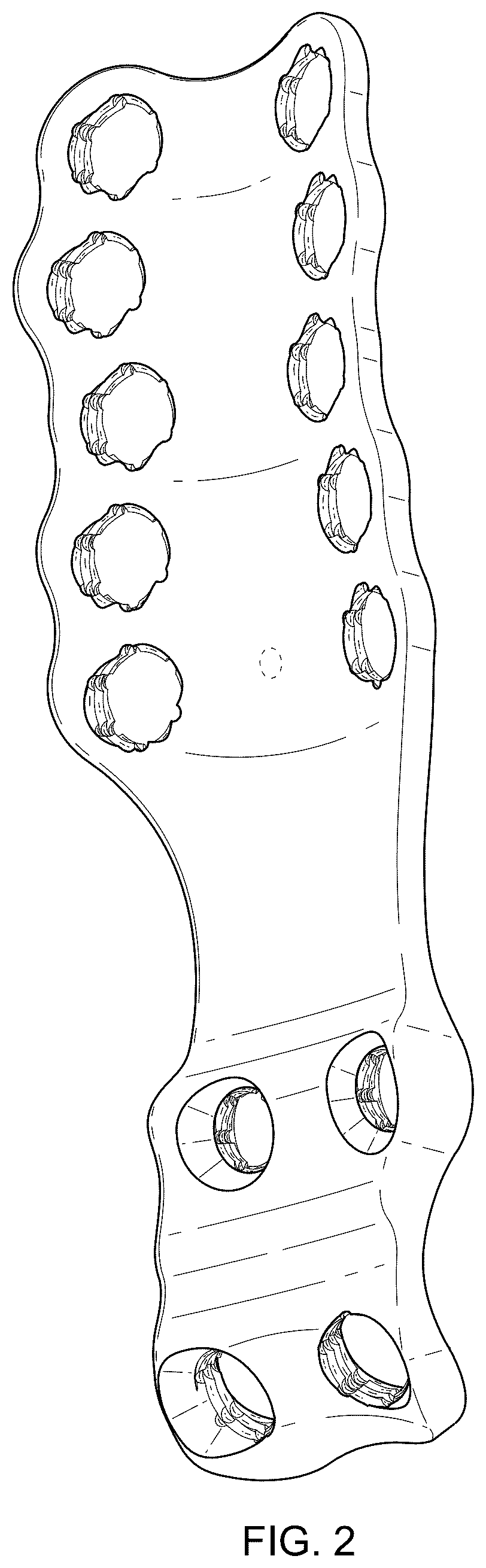 Patent USD1076090 Figure 2 – Straddle bone plate