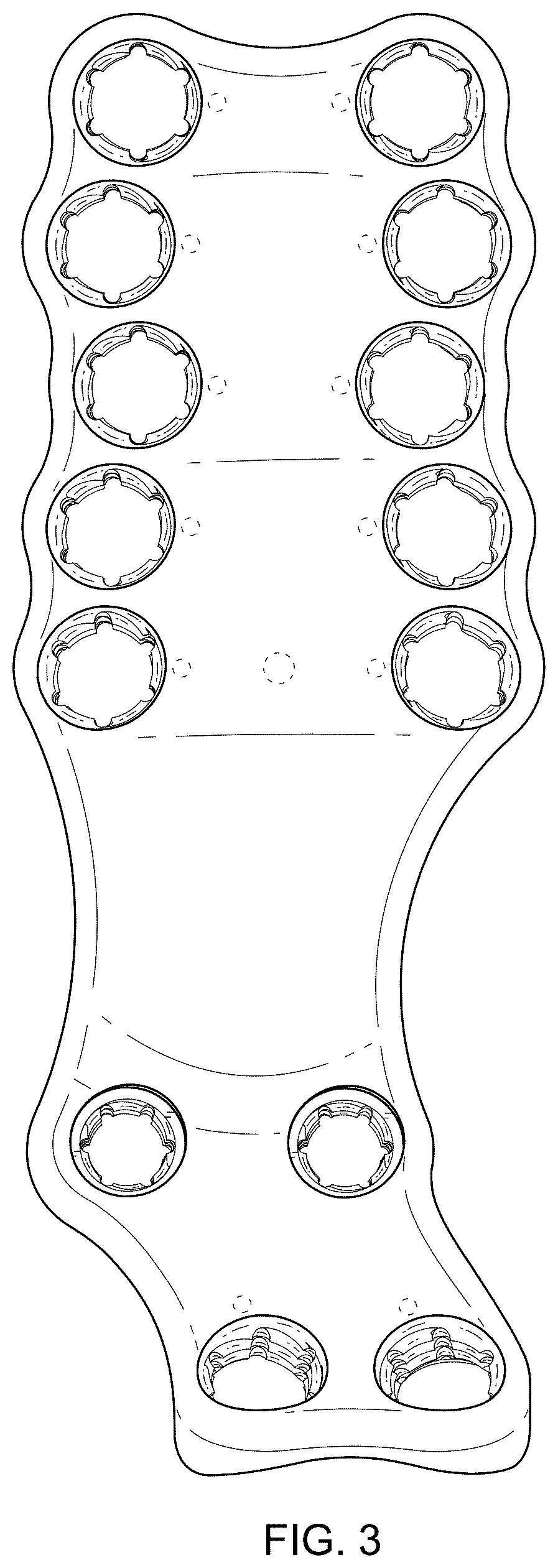 Patent USD1076090 Figure 3 – Straddle bone plate
