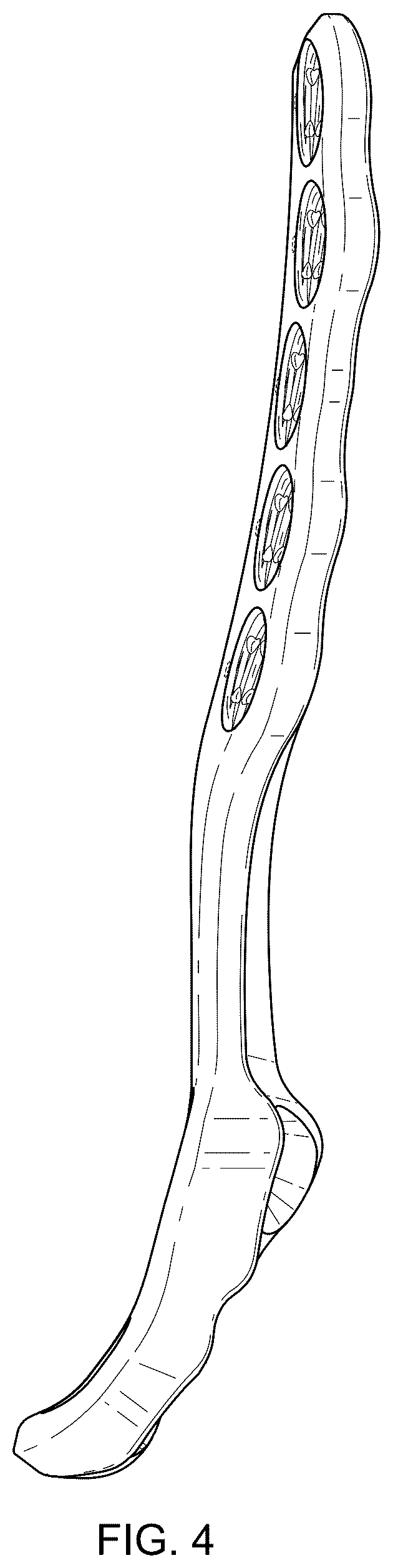 Patent USD1076090 Figure 4 – Straddle bone plate