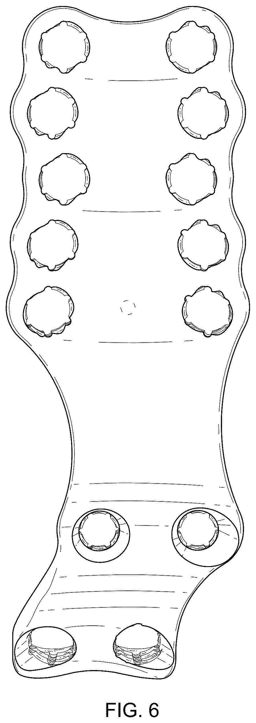 Patent USD1076090 Figure 6 – Straddle bone plate